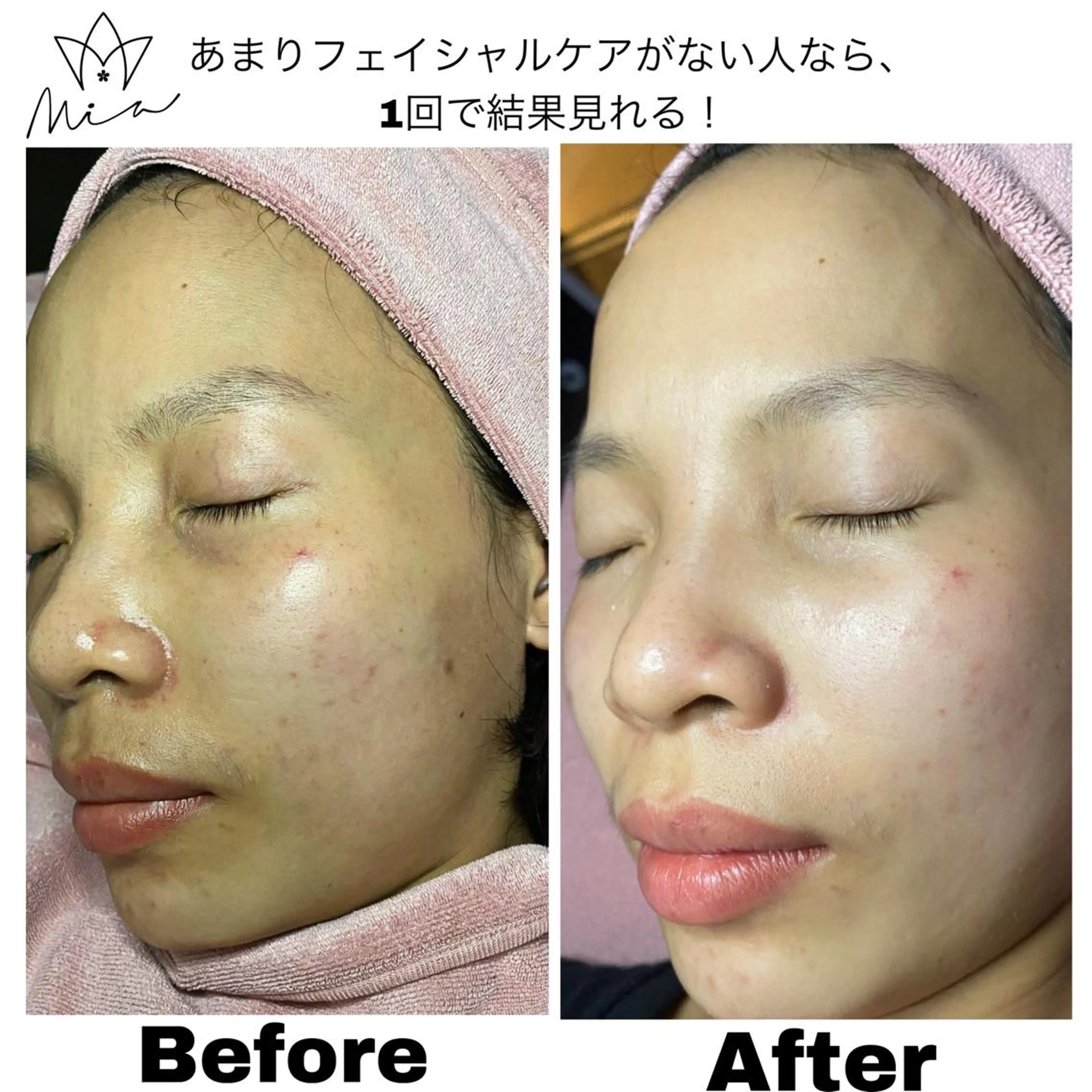 "Detox aqua essence skin"　60分 ! ￥9,360 -->￥5,616の写真