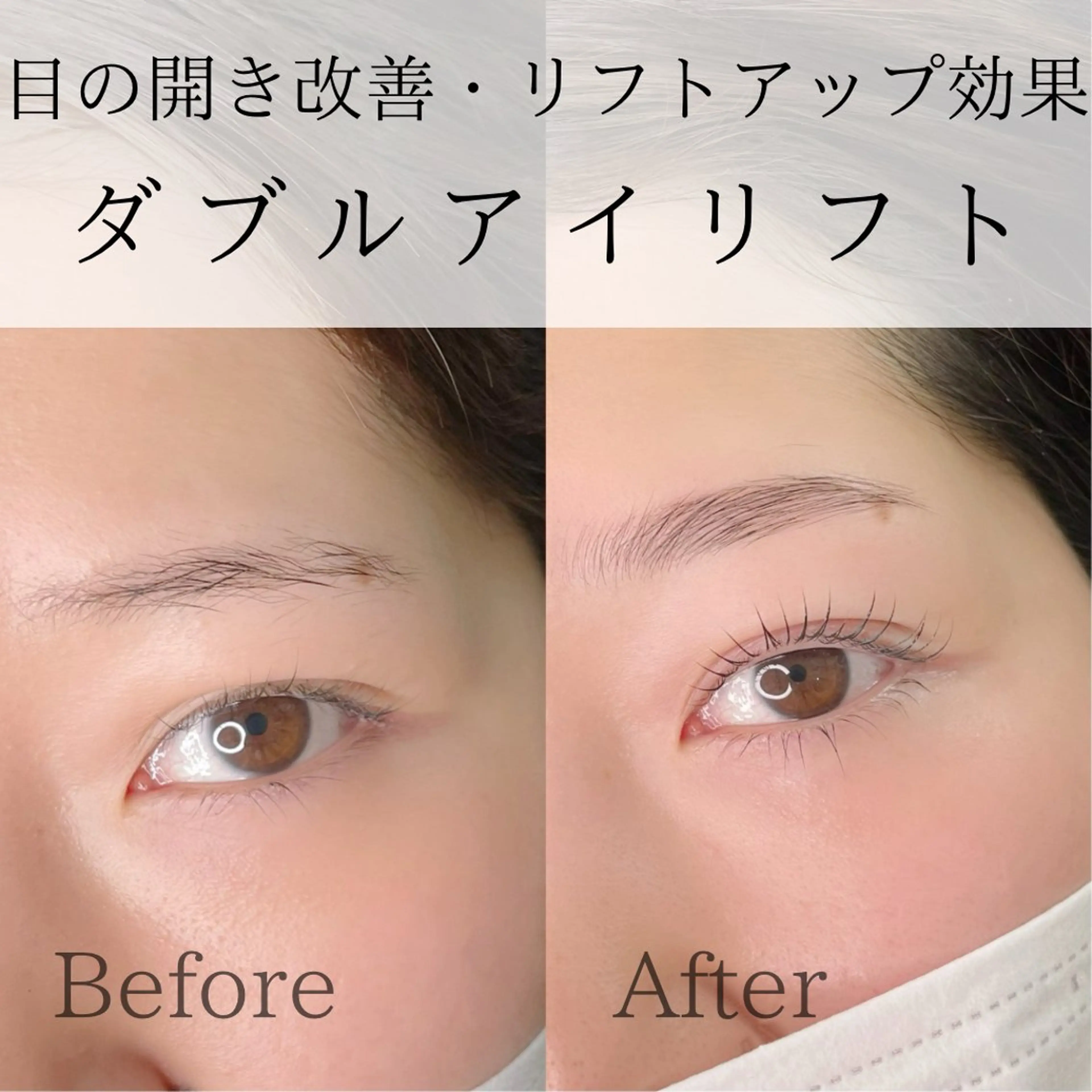 【ご新規様限定 minimo価格】浮腫・眼精疲労にも効果的のアイストレッチ込み✨ダブルアイリフト✨の写真