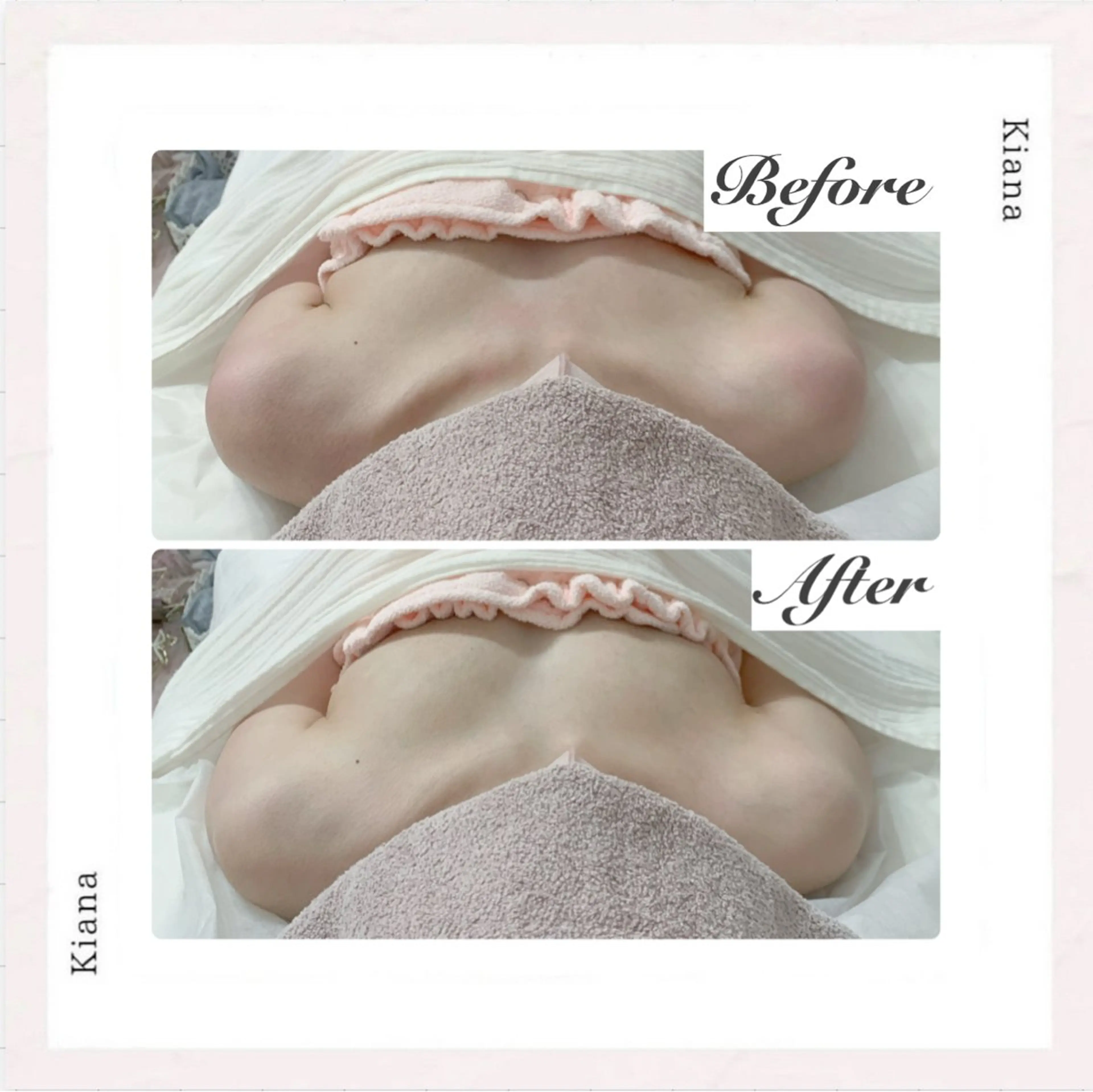 エステ リラク バスト専門Kiana 風のエステ・リラクイメージ