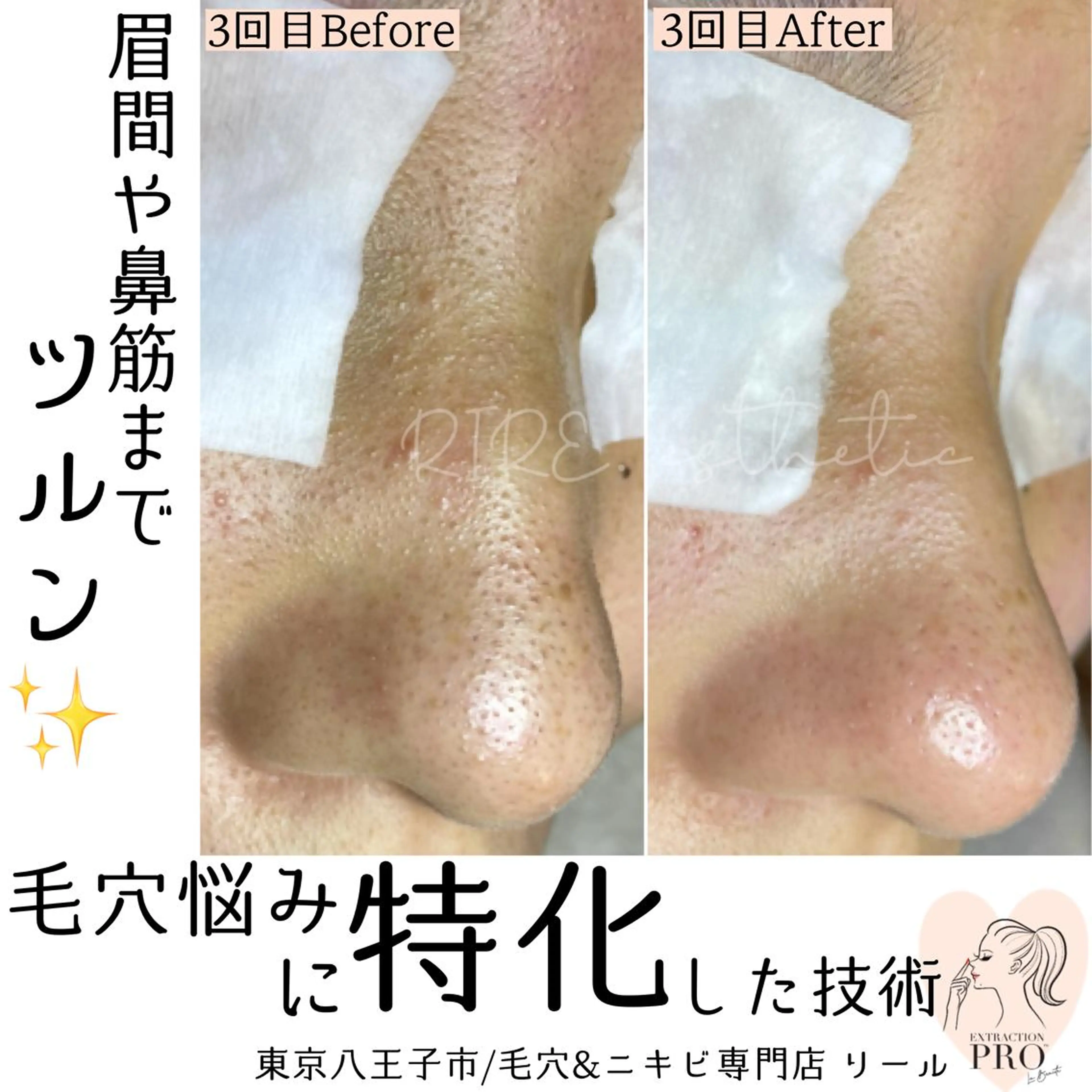 毛穴肌育専門店 リールのエステ・リラクイメージ