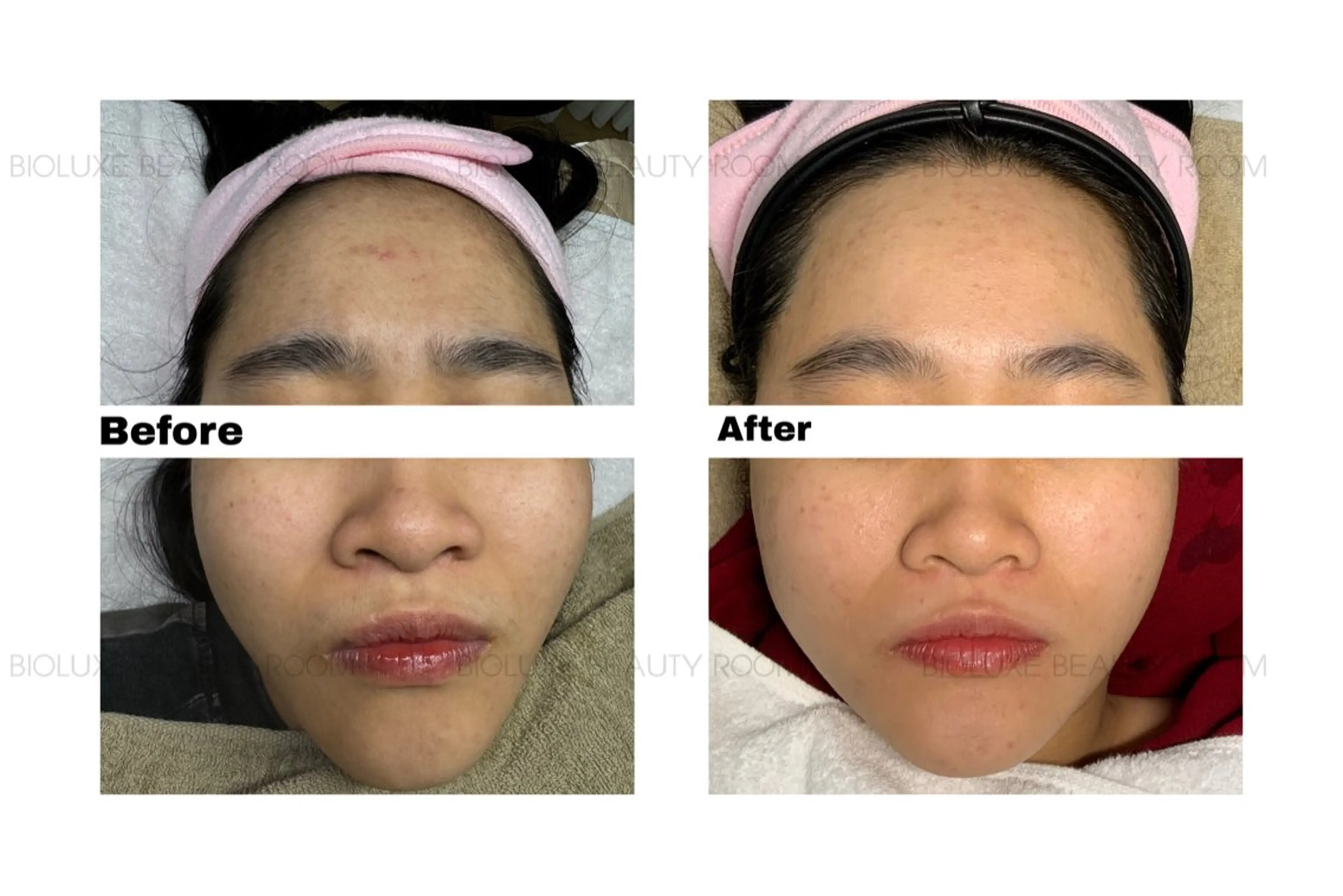 BIOLUXE BEAUTY所属・バイオラックス ビューティーのエステ・リラクイメージ