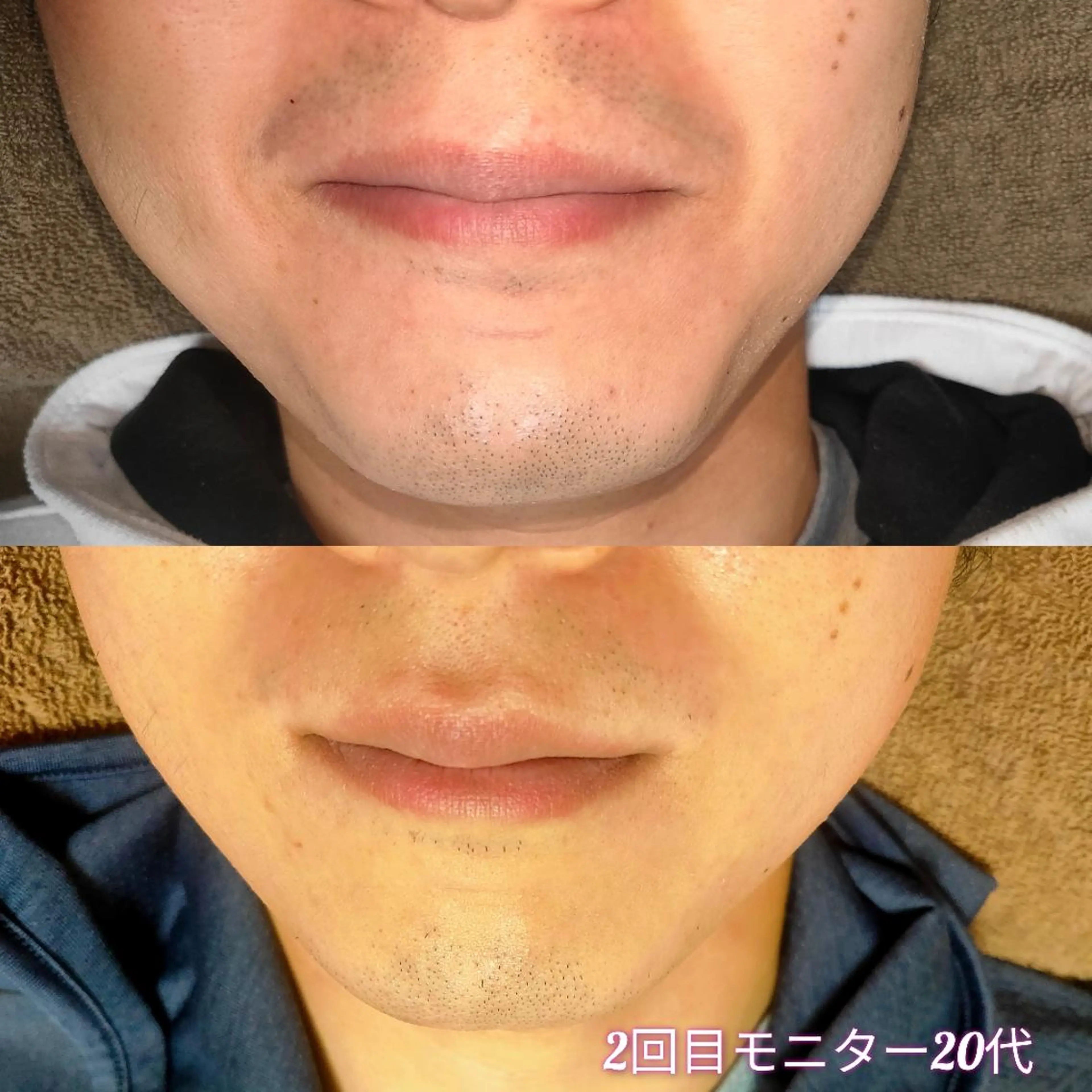 メンズ 脱毛 武 藤のエステ・リラクイメージ