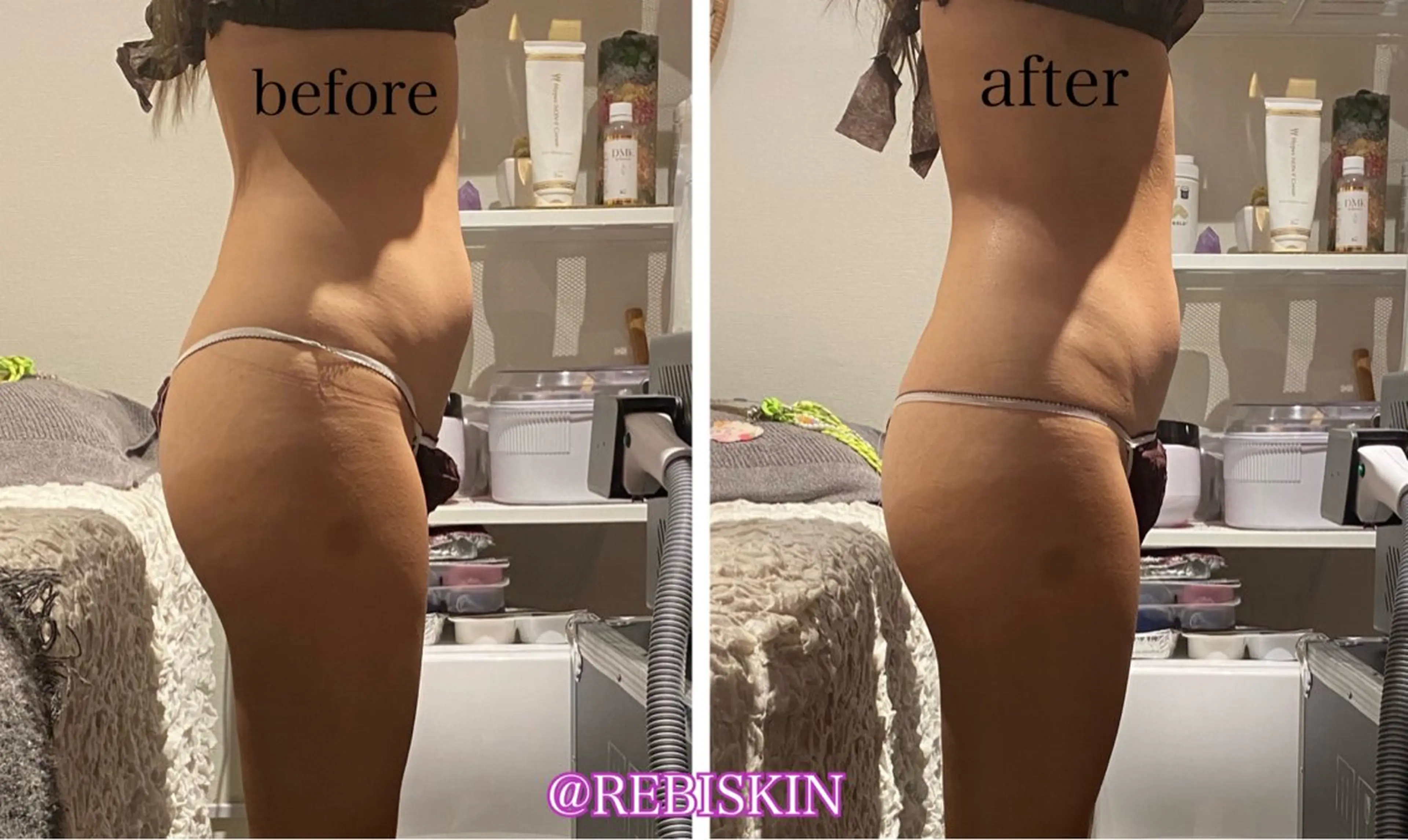エステ 【痩身・脱毛サロン】 REBISKIN🌱のエステ・リラクイメージ