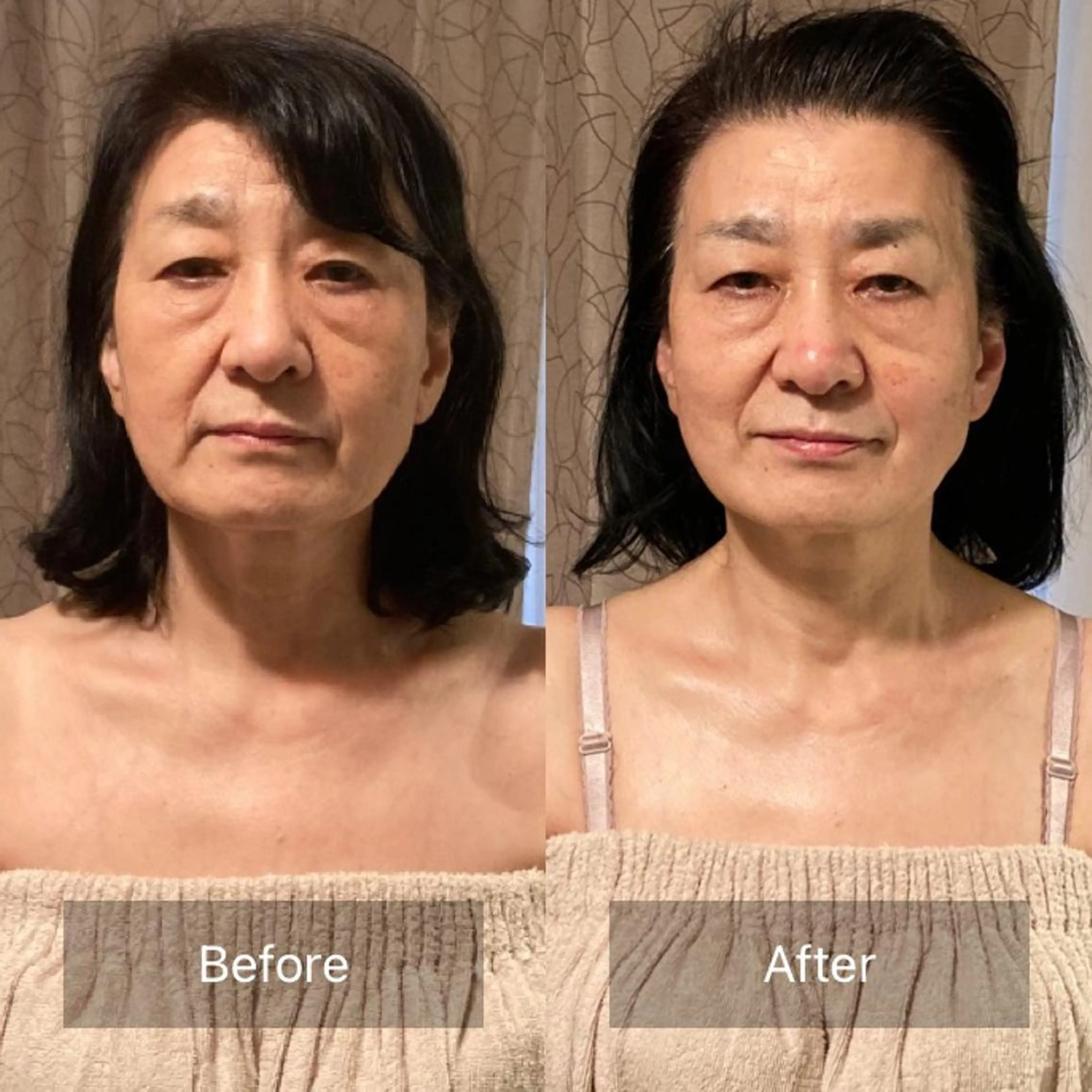 B&H所属・頭痛•肩こり専門/ 眉サロンB&H心斎橋のエステ・リラクイメージ