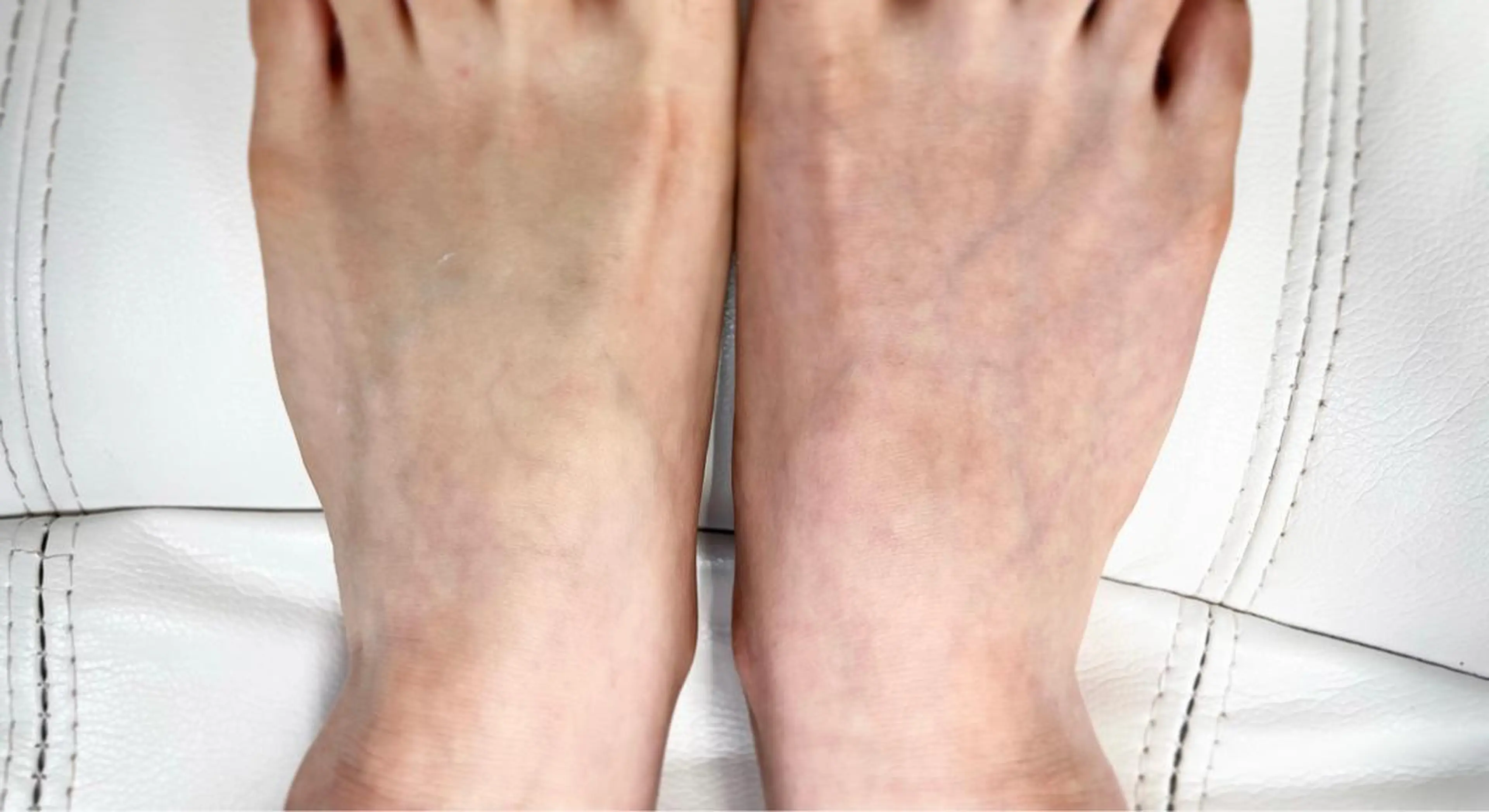 ネイル フットネイル 夏ネイル RIONnail(リオンネイル)所属・RIONnail Yurikaのネイルデザイン