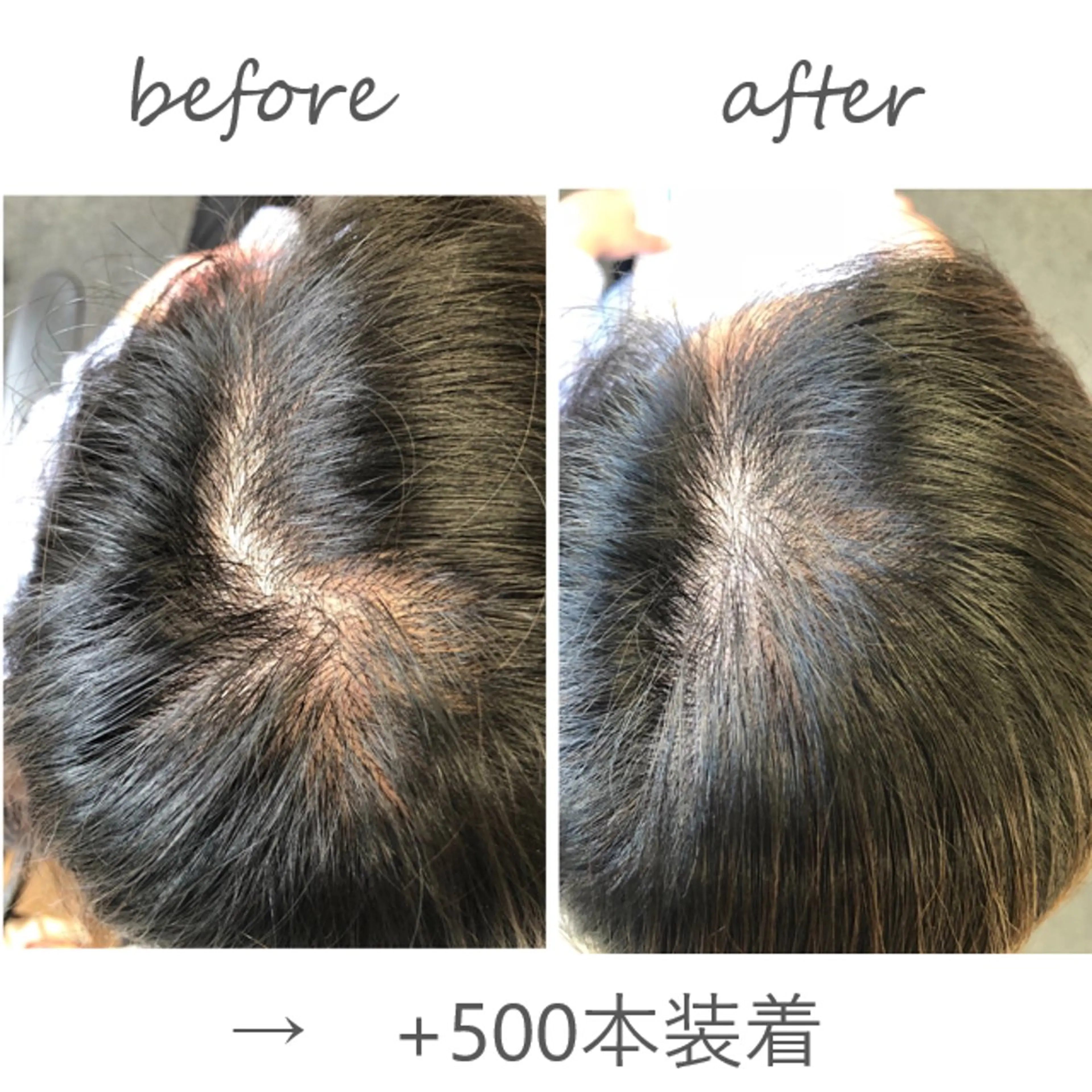 お試しカウンセリング＋増毛エクステ500本の写真