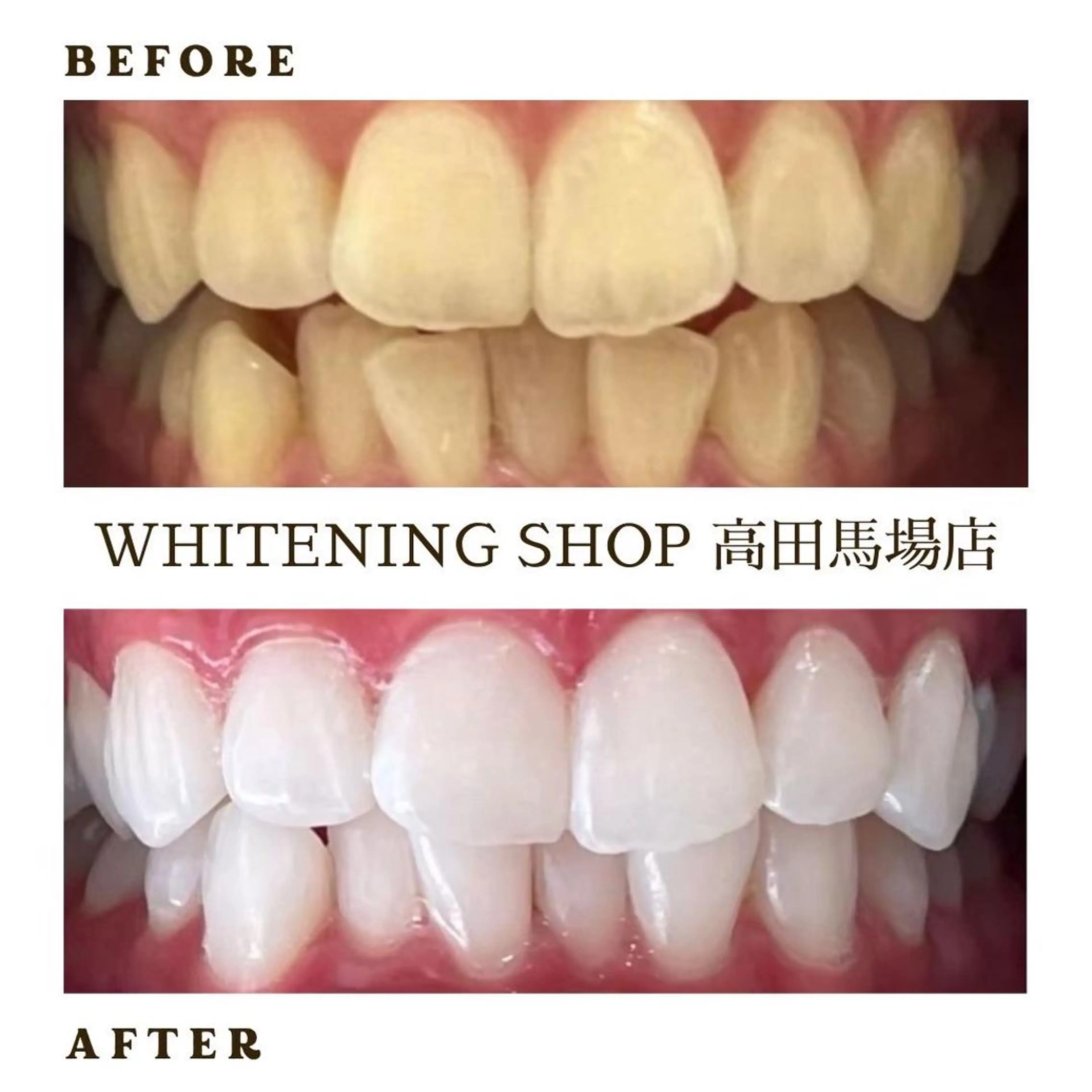 メンズ その他 ホワイトニング ショップ高田馬場店のその他イメージ