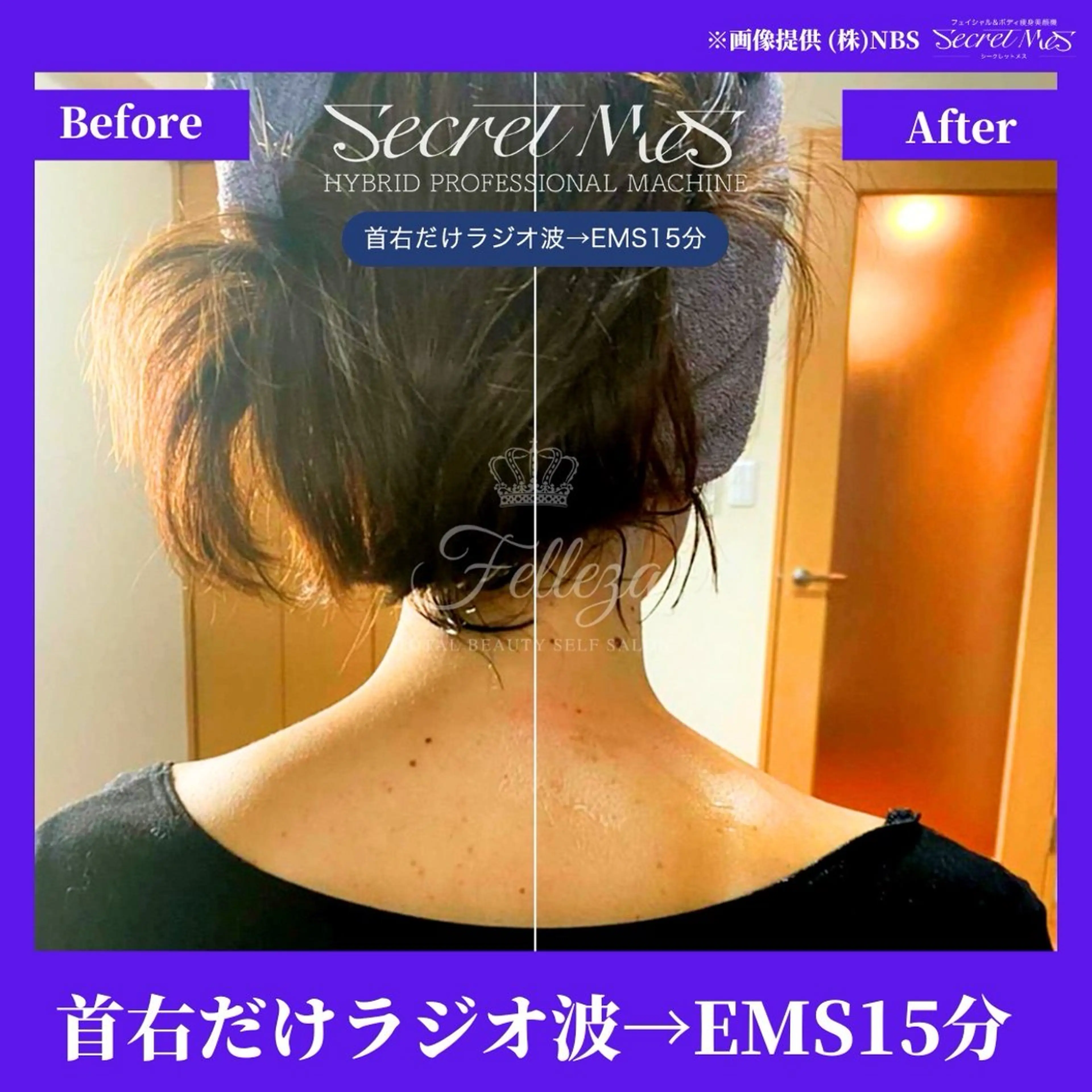 メンズ 有人型セルフサロン 脱毛／痩身／美顔のエステ・リラクイメージ