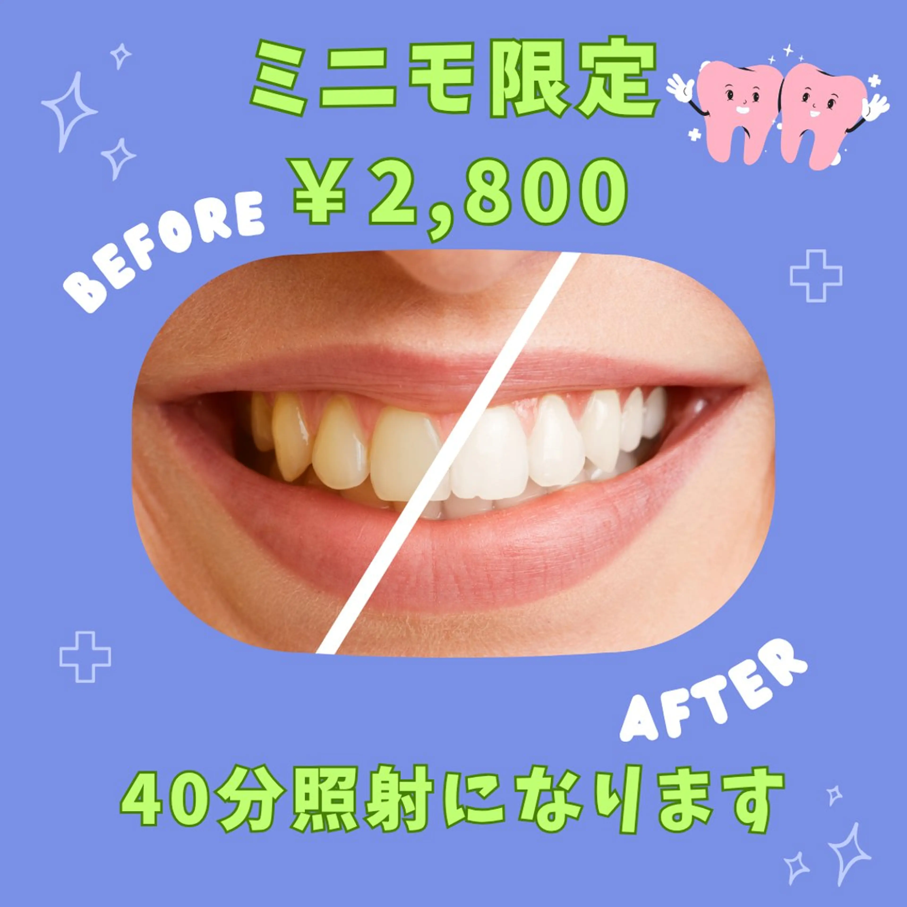 🩵ミニモ限定🩵【お試し体験】４０分照射¥2800✨️一度のご来店で効果実感！！の写真