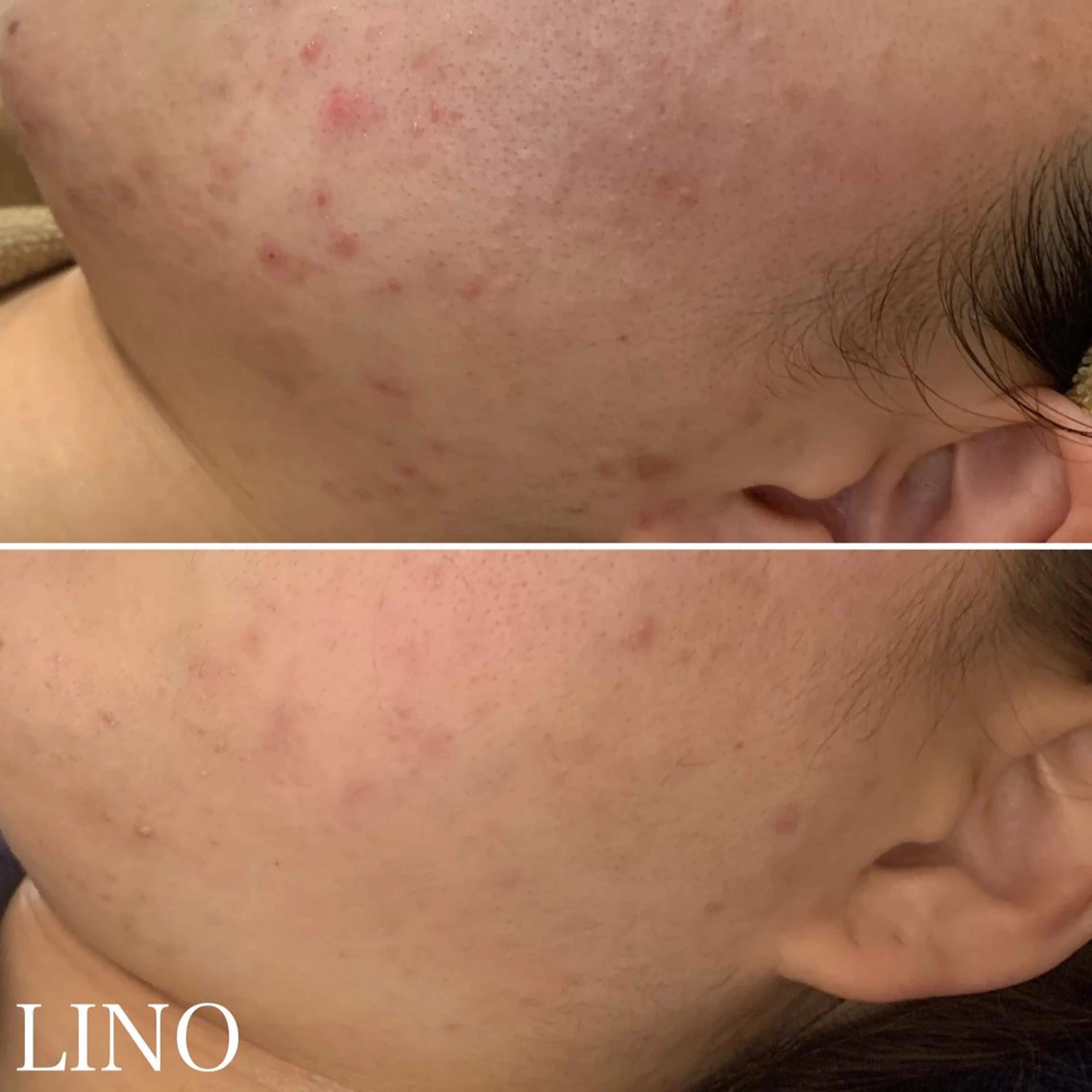 beautysalon  LINO所属・7月限定【平日限定】 全メニュ¥4,400のエステ・リラクイメージ