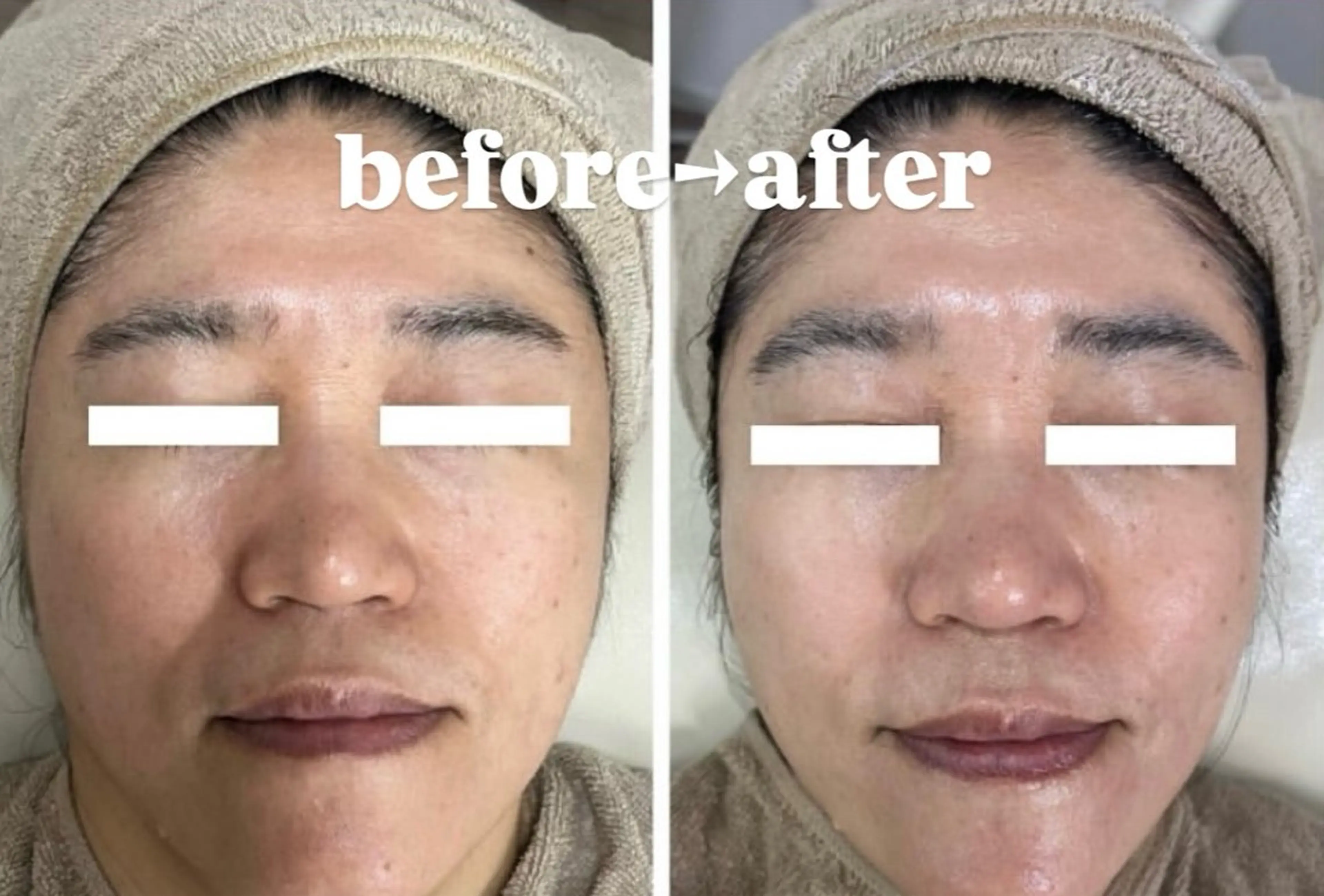 その他 Skincare Room〜Caaka〜所属・橋本 千寿のエステ・リラクイメージ