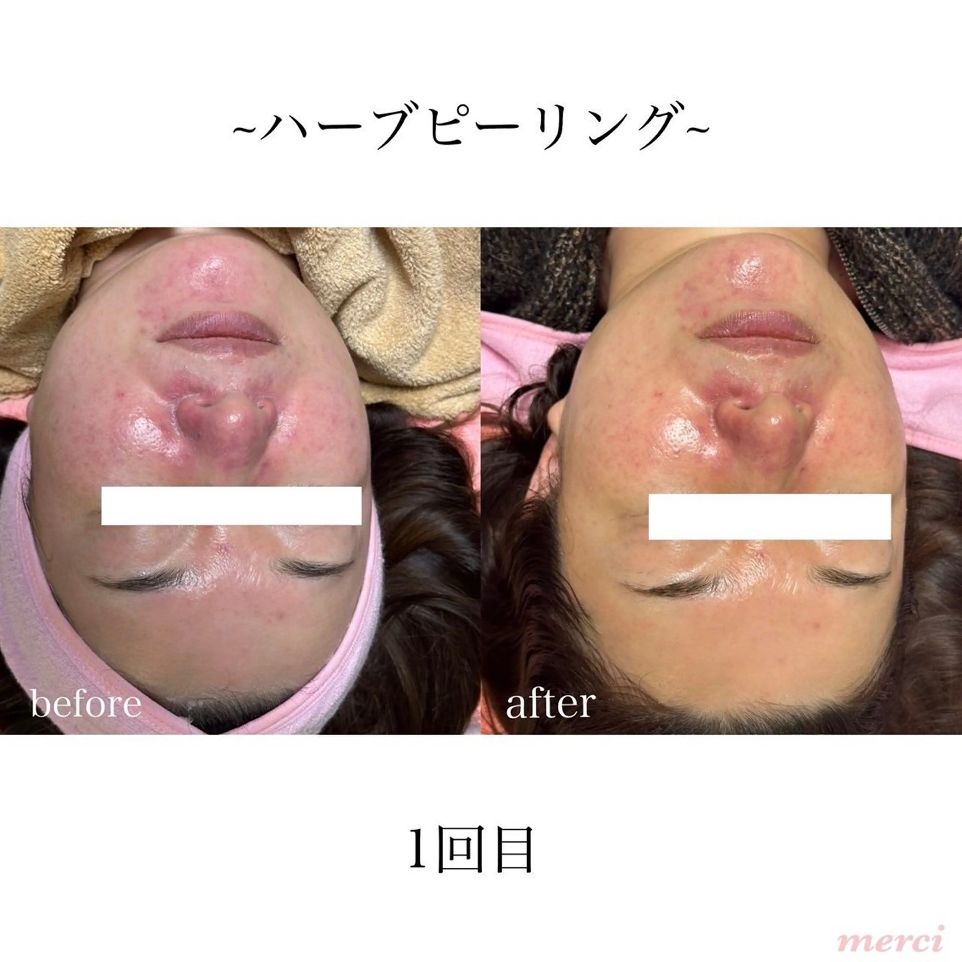 salon merciのエステ・リラクイメージ
