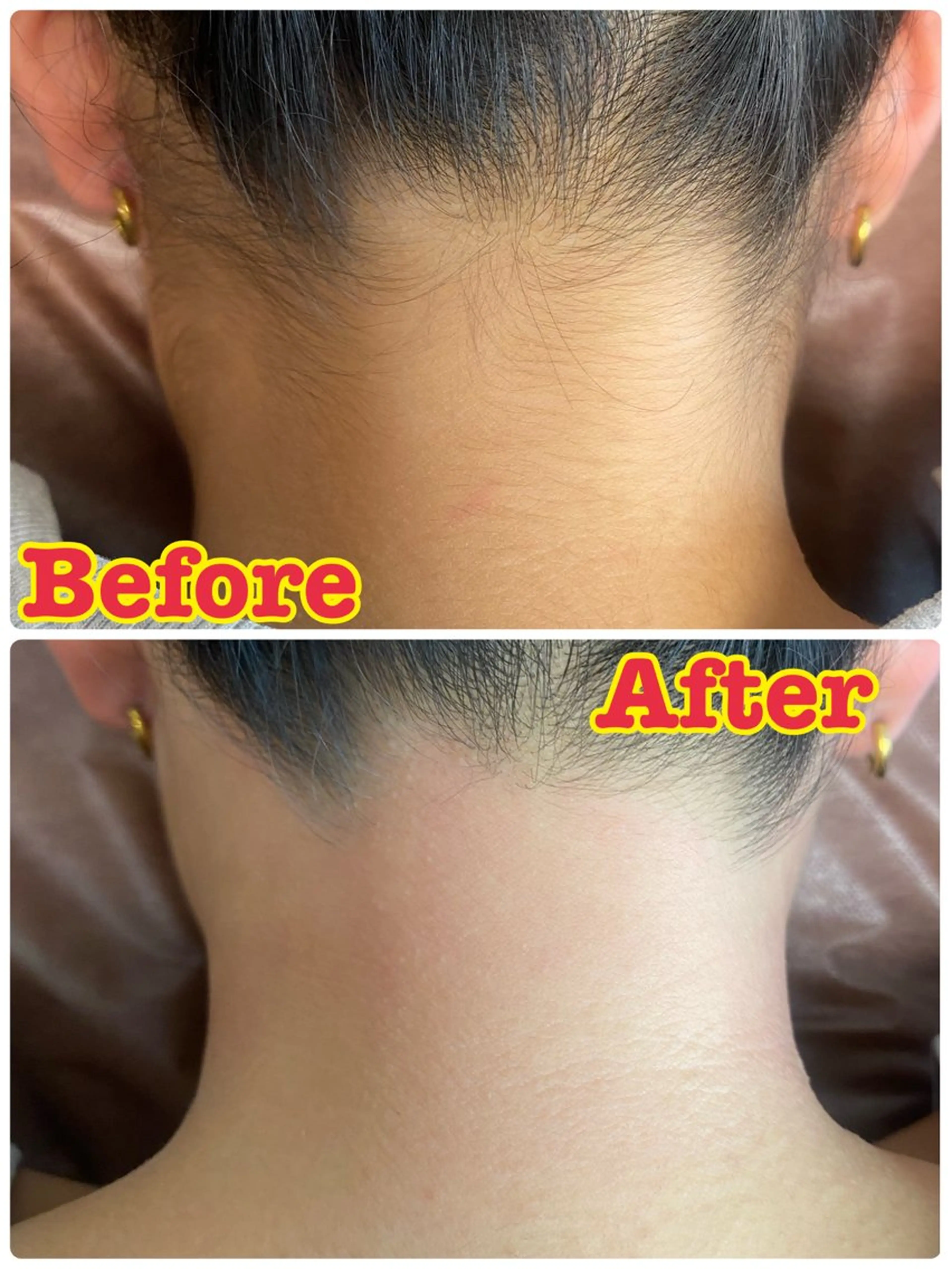 脱毛 sugaring salon Malo所属・シュガーリングサロン Maloのエステ・リラクイメージ