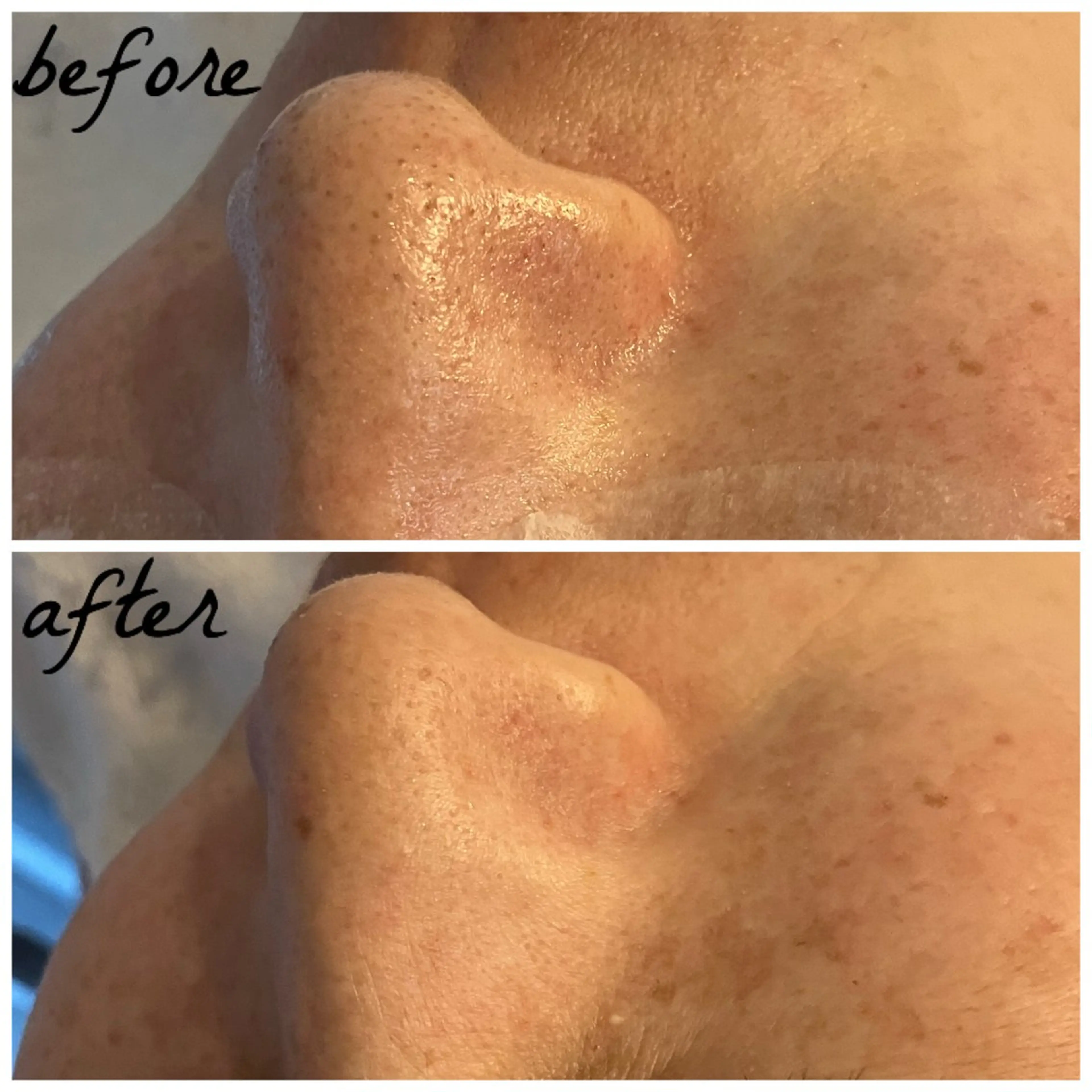 メンズ メナード岐阜茜部 杉浦のエステ・リラクイメージ