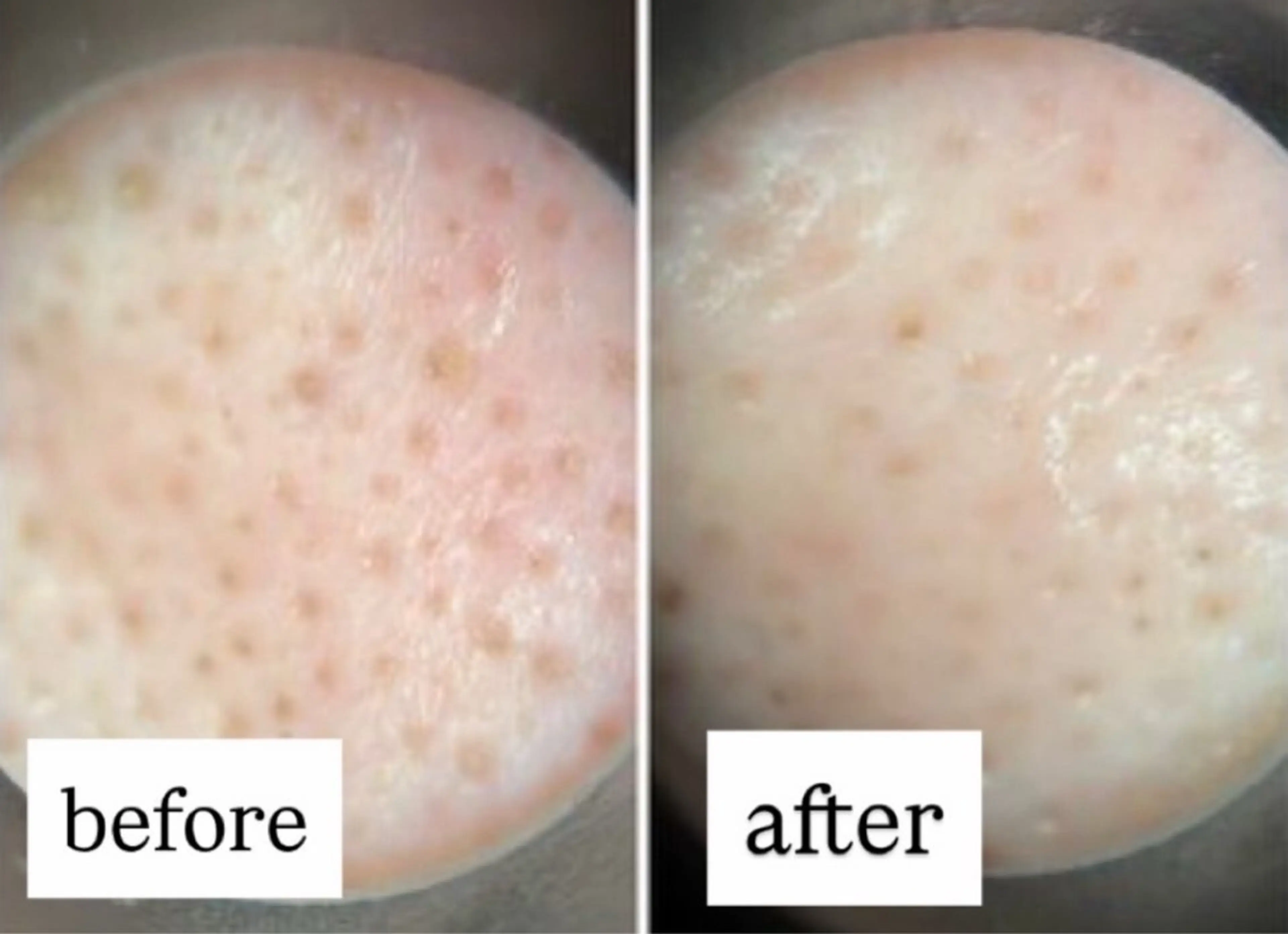 メナードツカサドウ Amiのエステ・リラクイメージ