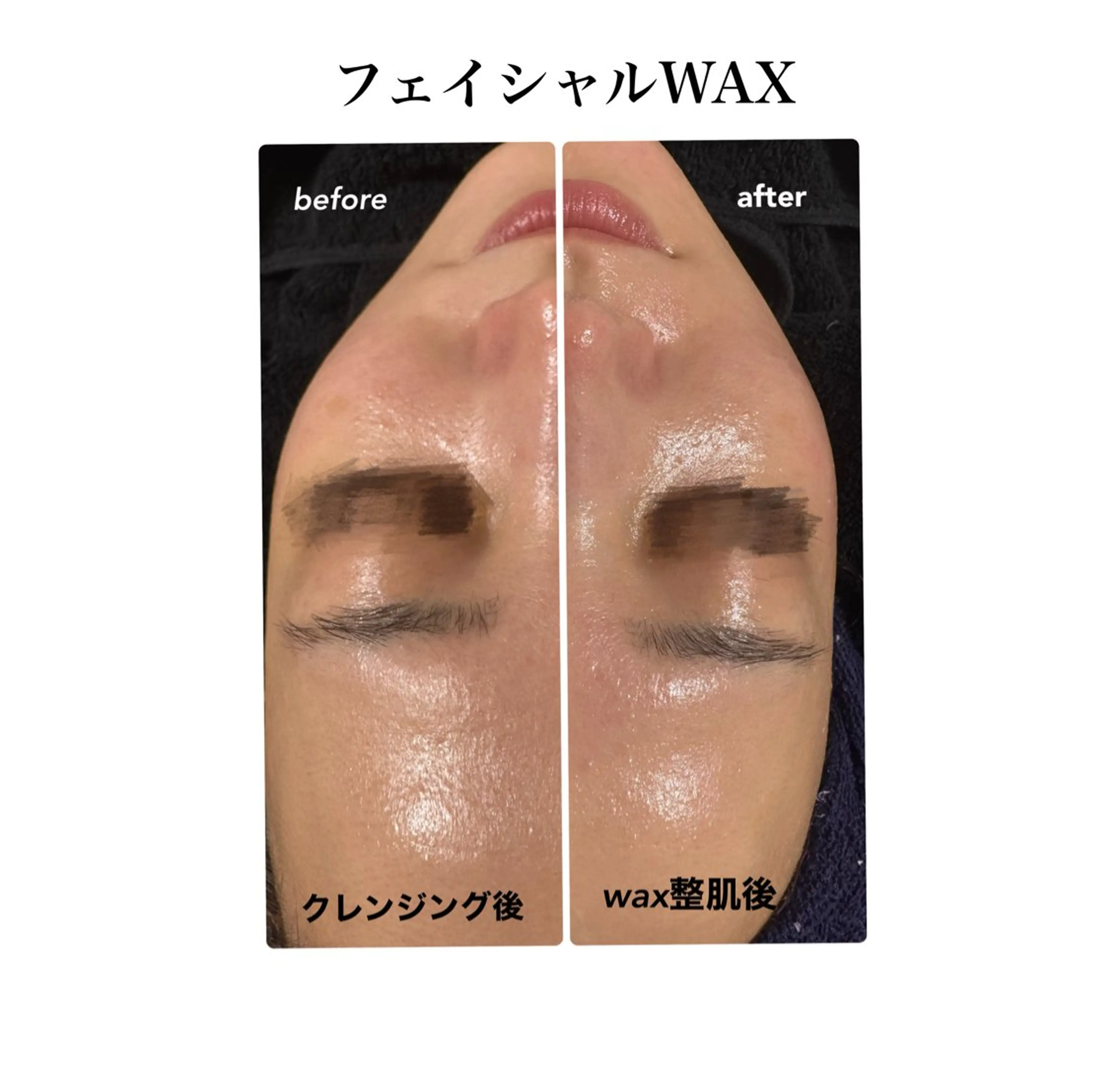 🎀極ツヤ肌フェイシャルWAX🎀の写真