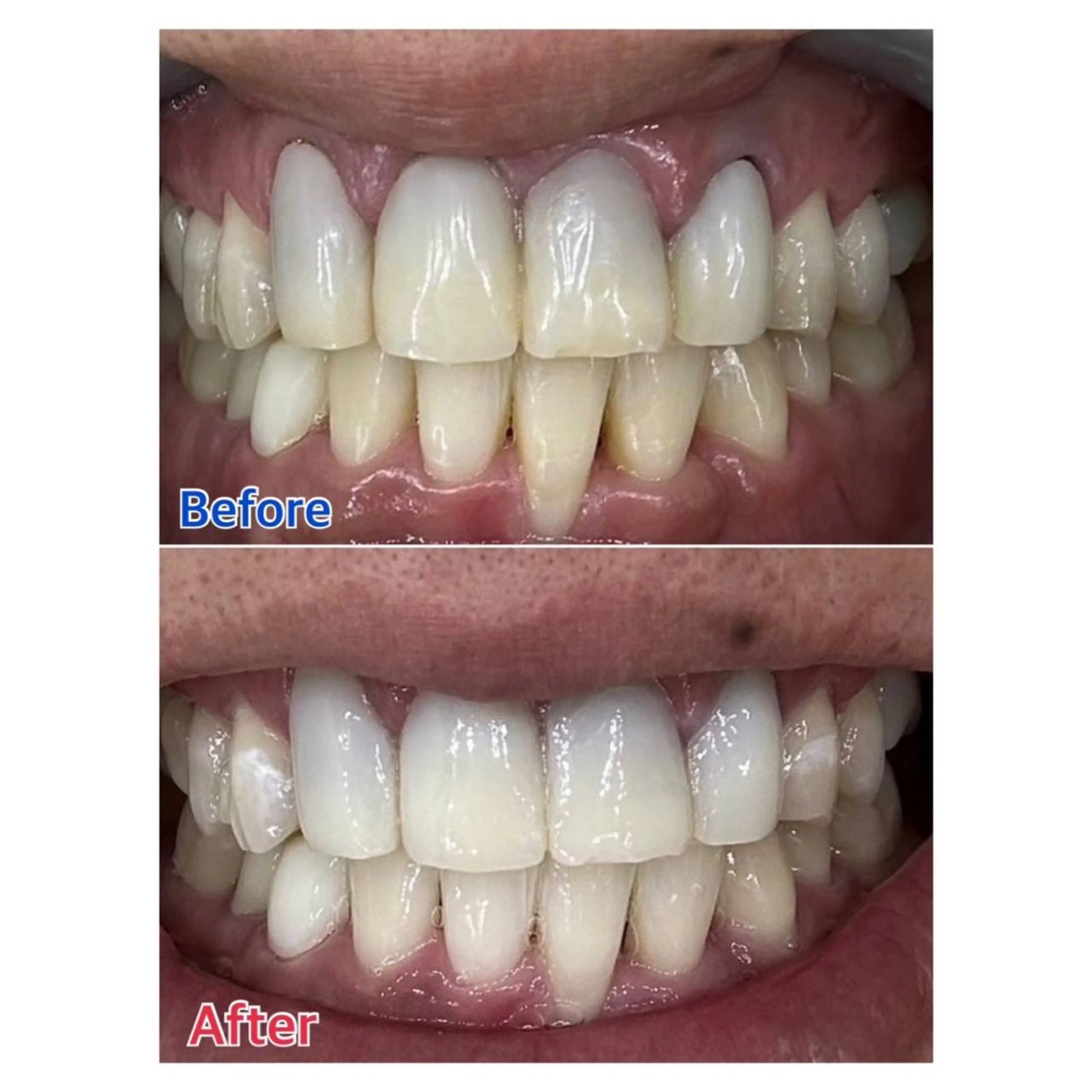 MBEAUTYSALON 千葉店・京成大久保所属・Melty 輝のその他イメージ