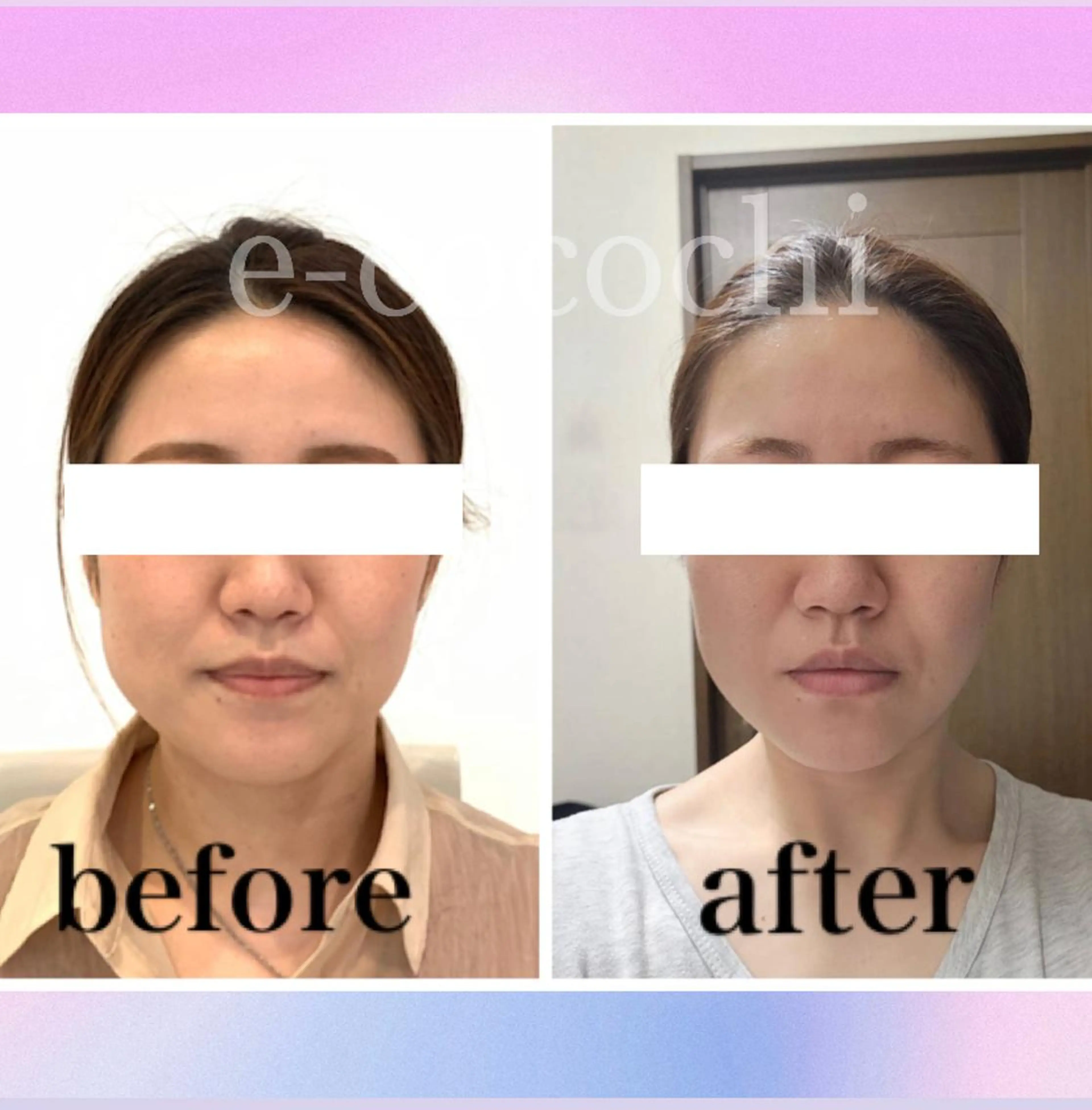 エステ リラク 小顔と ヘッドスパのお店のエステ・リラクイメージ