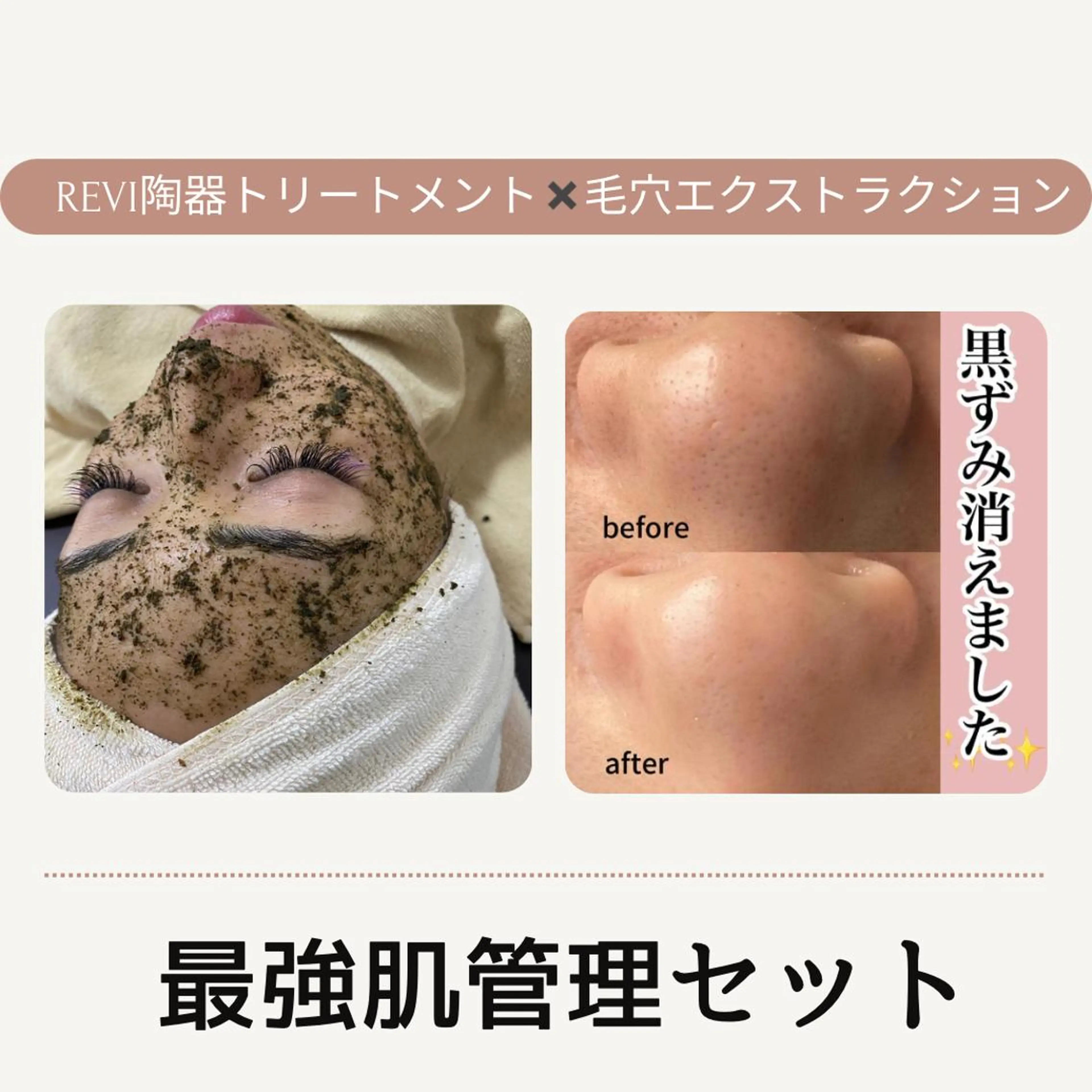 ■超絶小顔＆肌管理室■所属・🦋整形級の究極美顔 本格韓国式小顔🦋のエステ・リラクイメージ