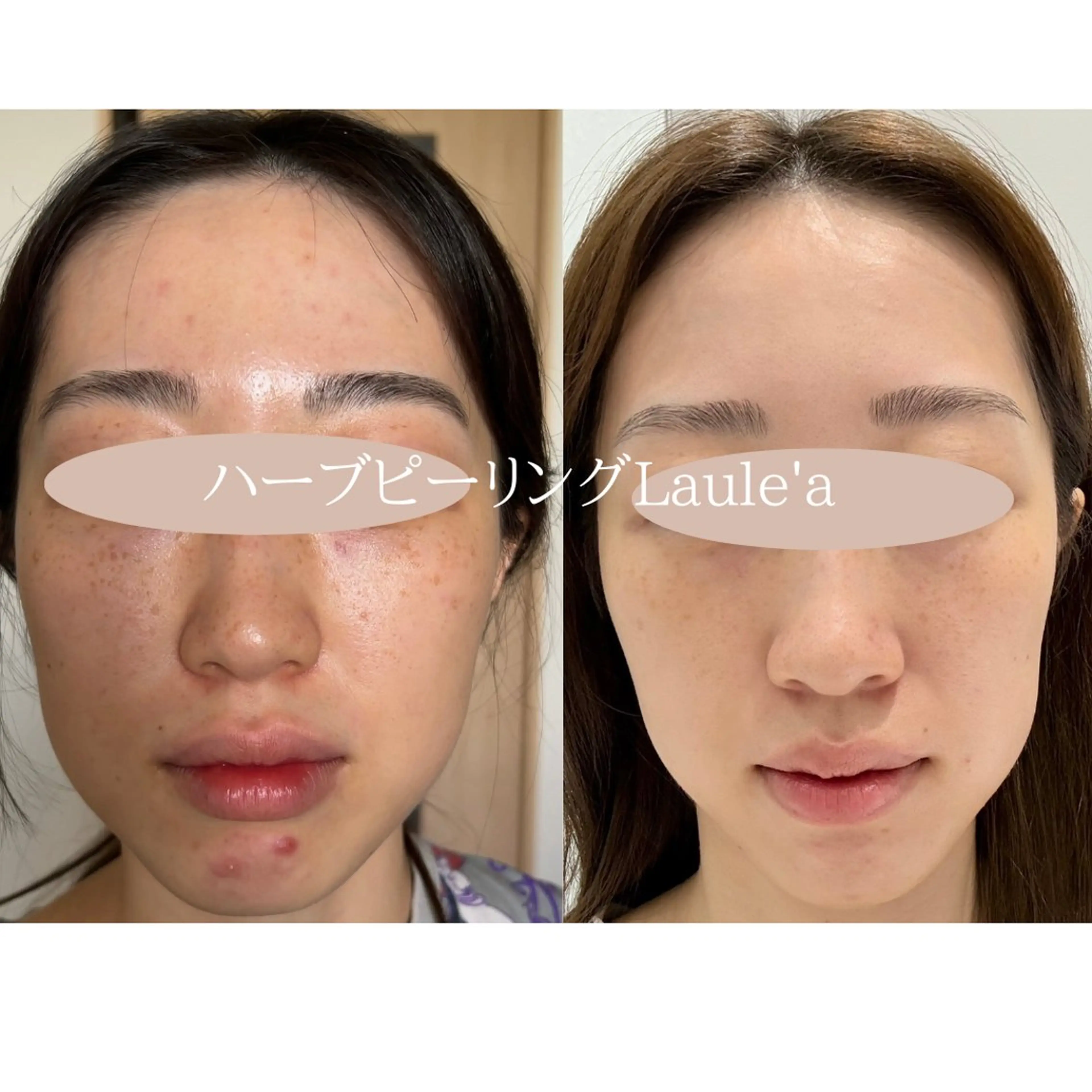 痩身/腸もみ/ ヘッドスパ/リンパのエステ・リラクイメージ