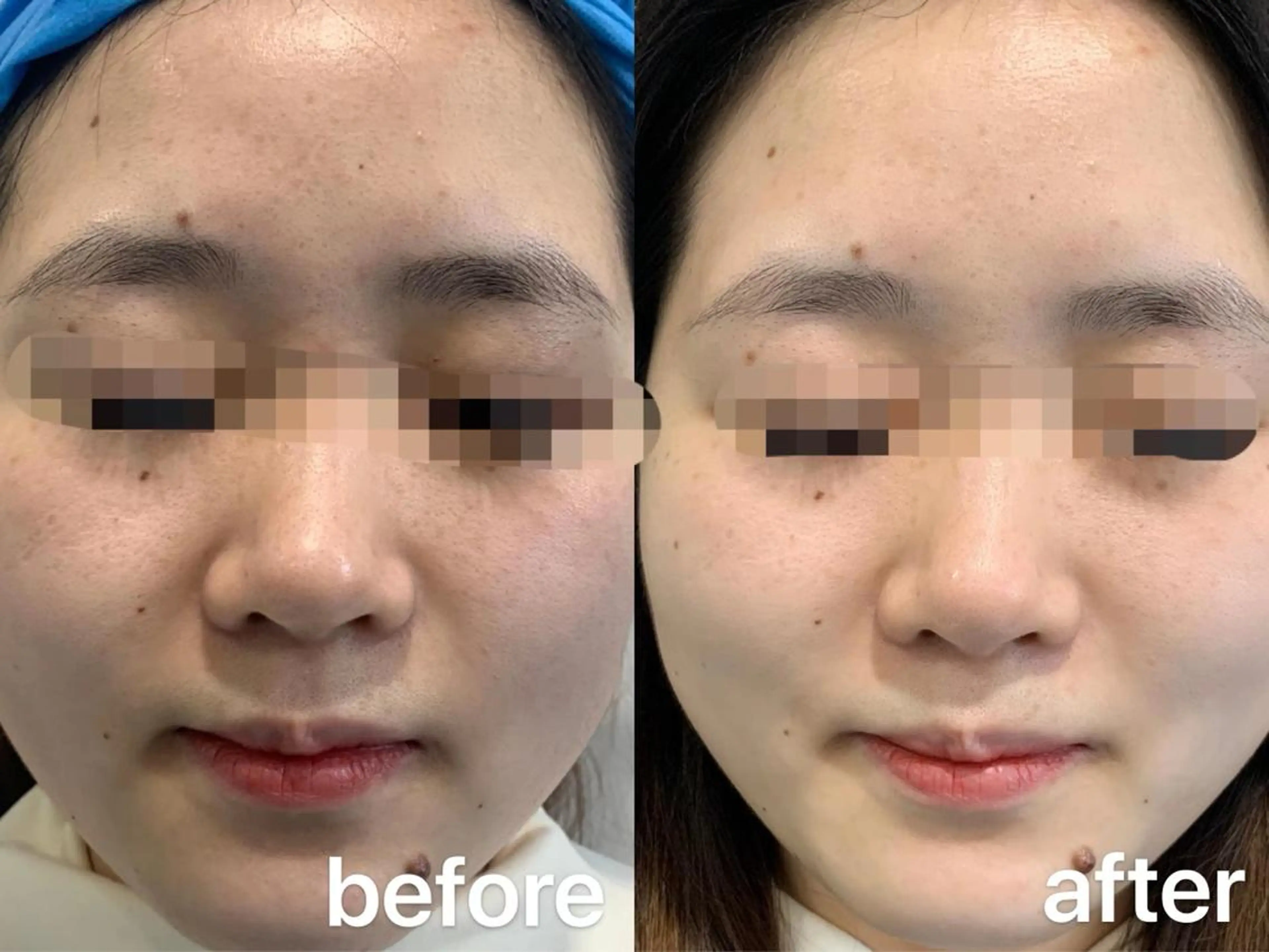 カラー パーマ ヘアアレンジ メンズ キッズ ネイル マツエク・マツパ アイブロウ Einami 美肌痩身サロンのエステ・リラクイメージ