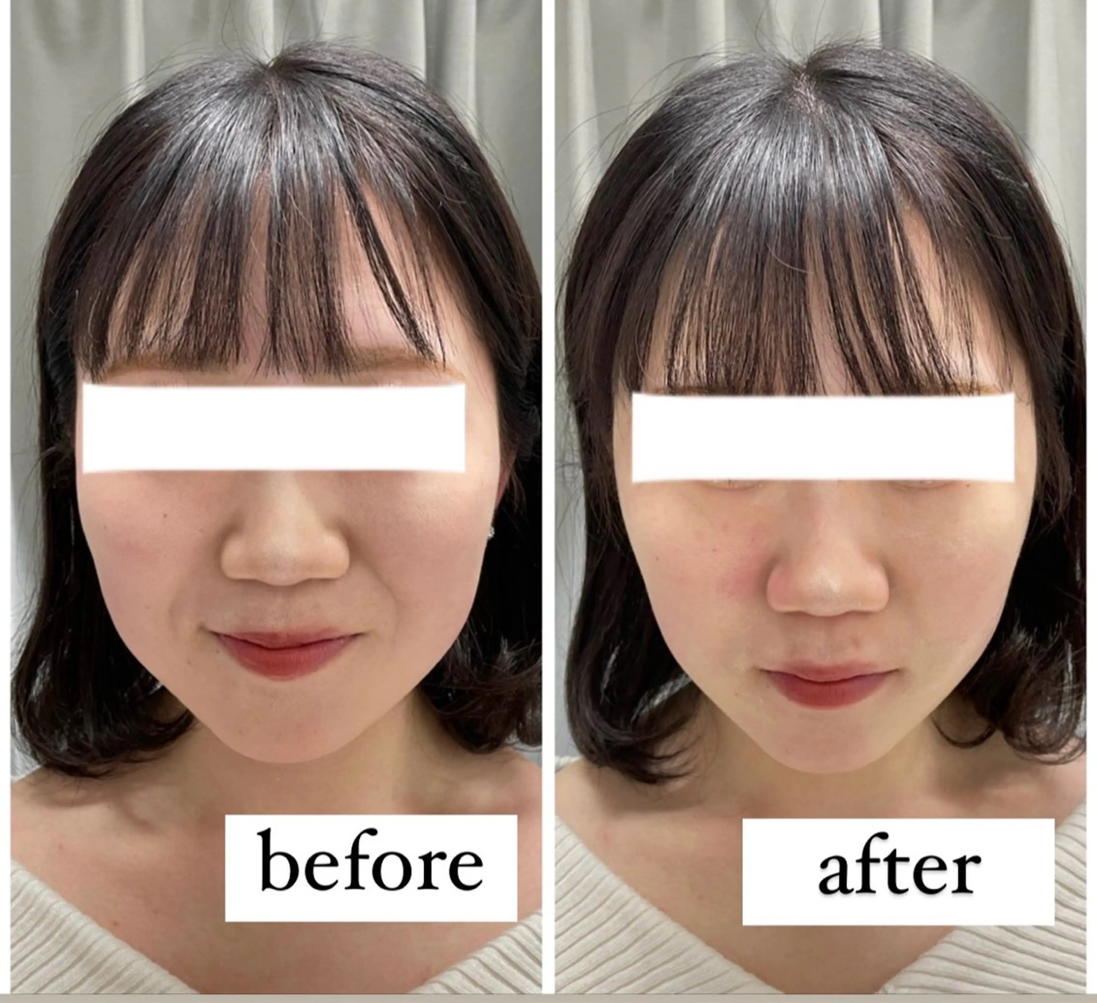 その他 ENCHANT 脱毛.小顔.毛穴のエステ・リラクイメージ