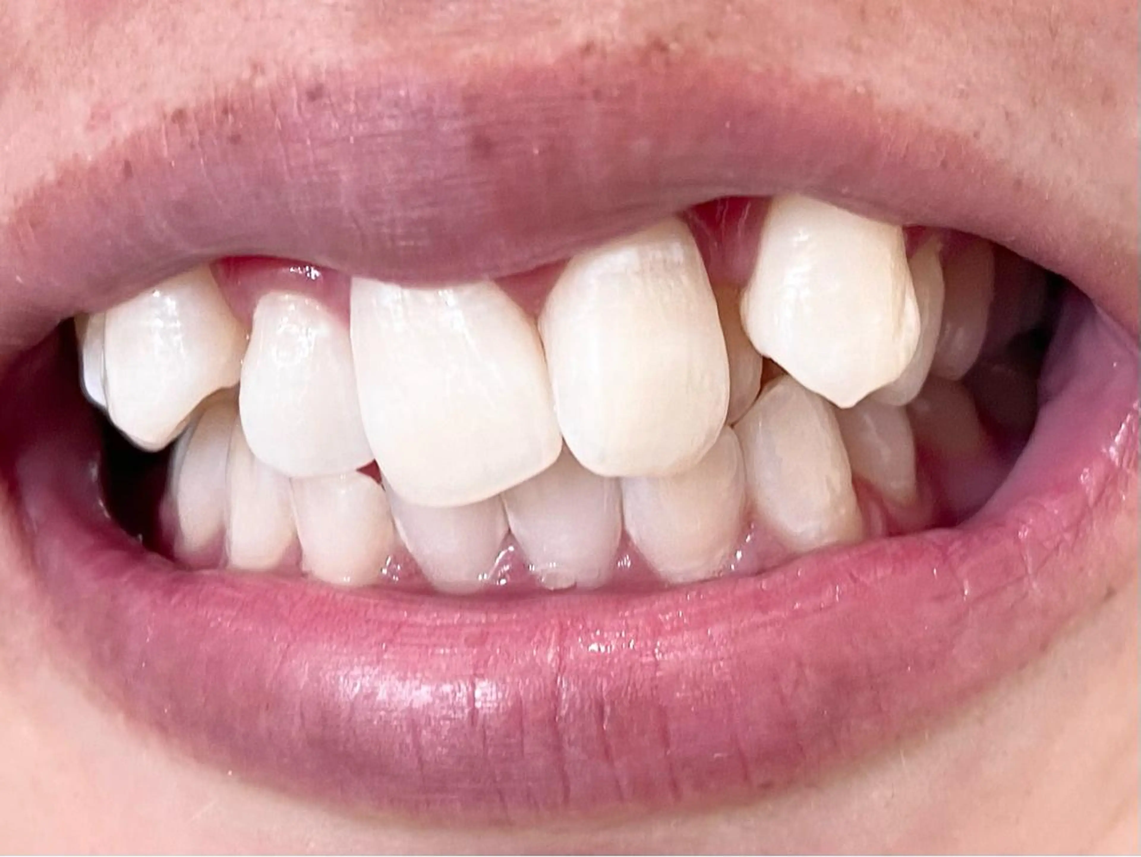 セルフホワイトニングサロン　ラヴィアン所属・ホワイトニングサロン La vie enのその他イメージ