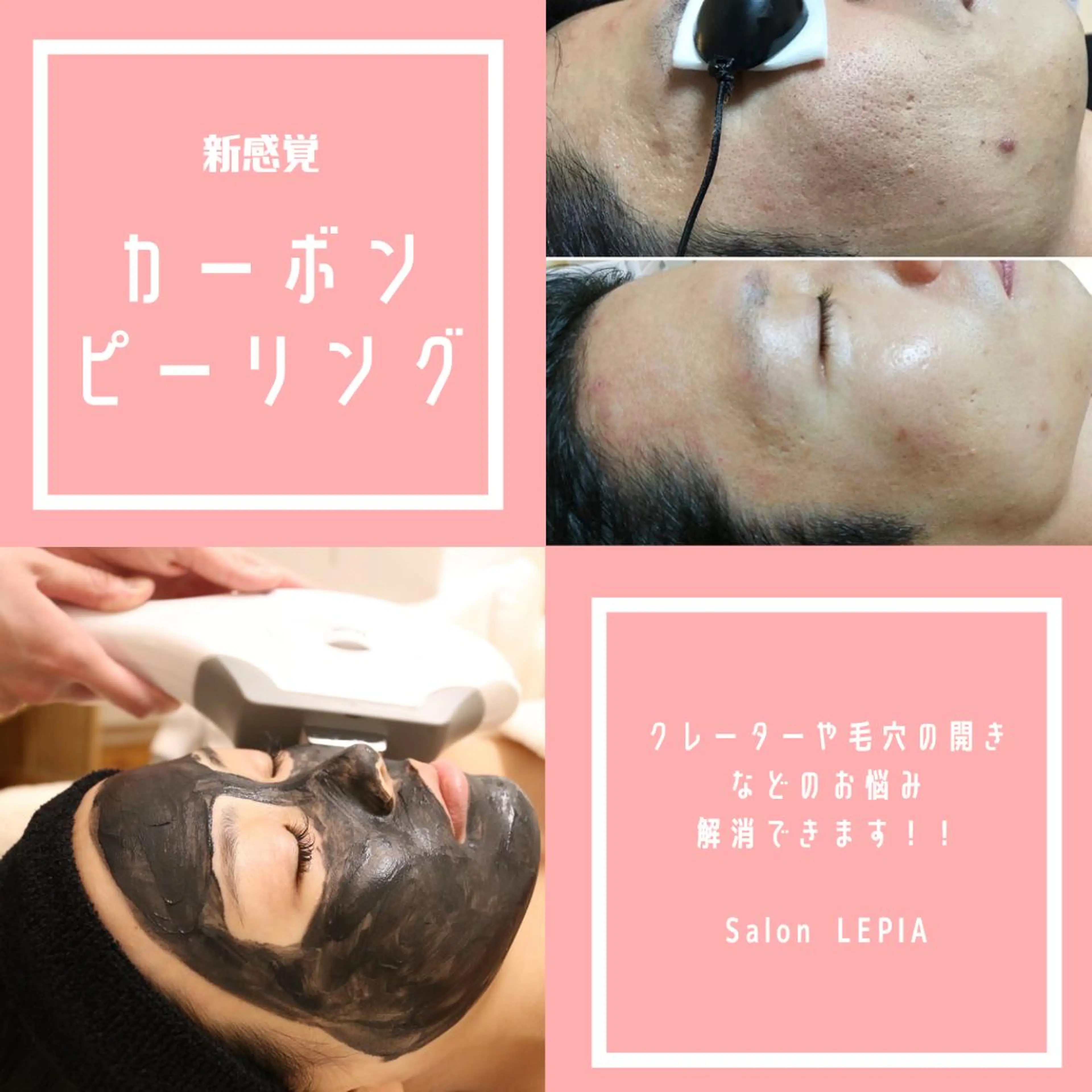 男女同額完全個室脱毛 LEPIA内田のエステ・リラクイメージ