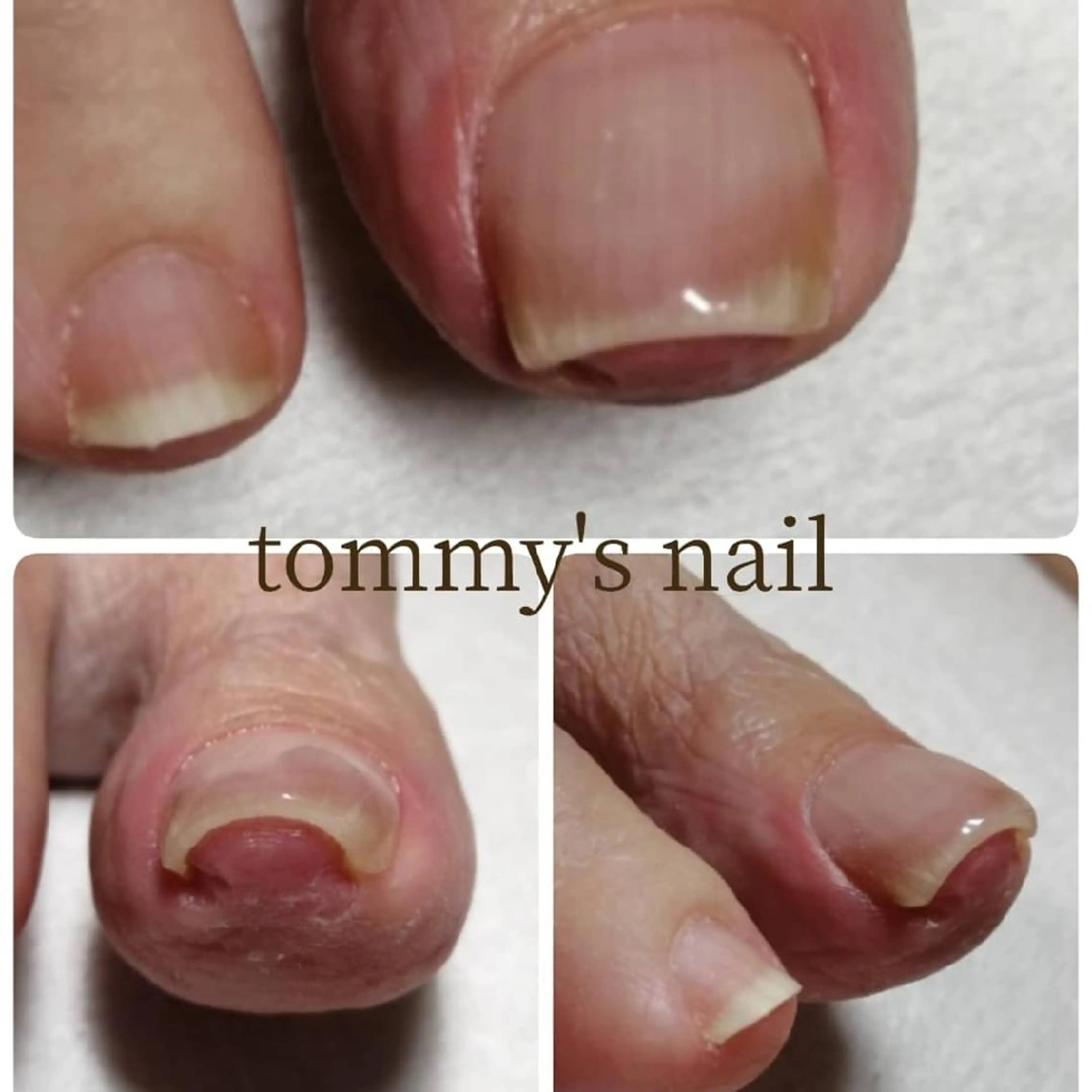 ネイル フットネイル tommy's nail所属・福岡/若よもぎ蒸し 全身美容が叶うサロンのネイルデザイン