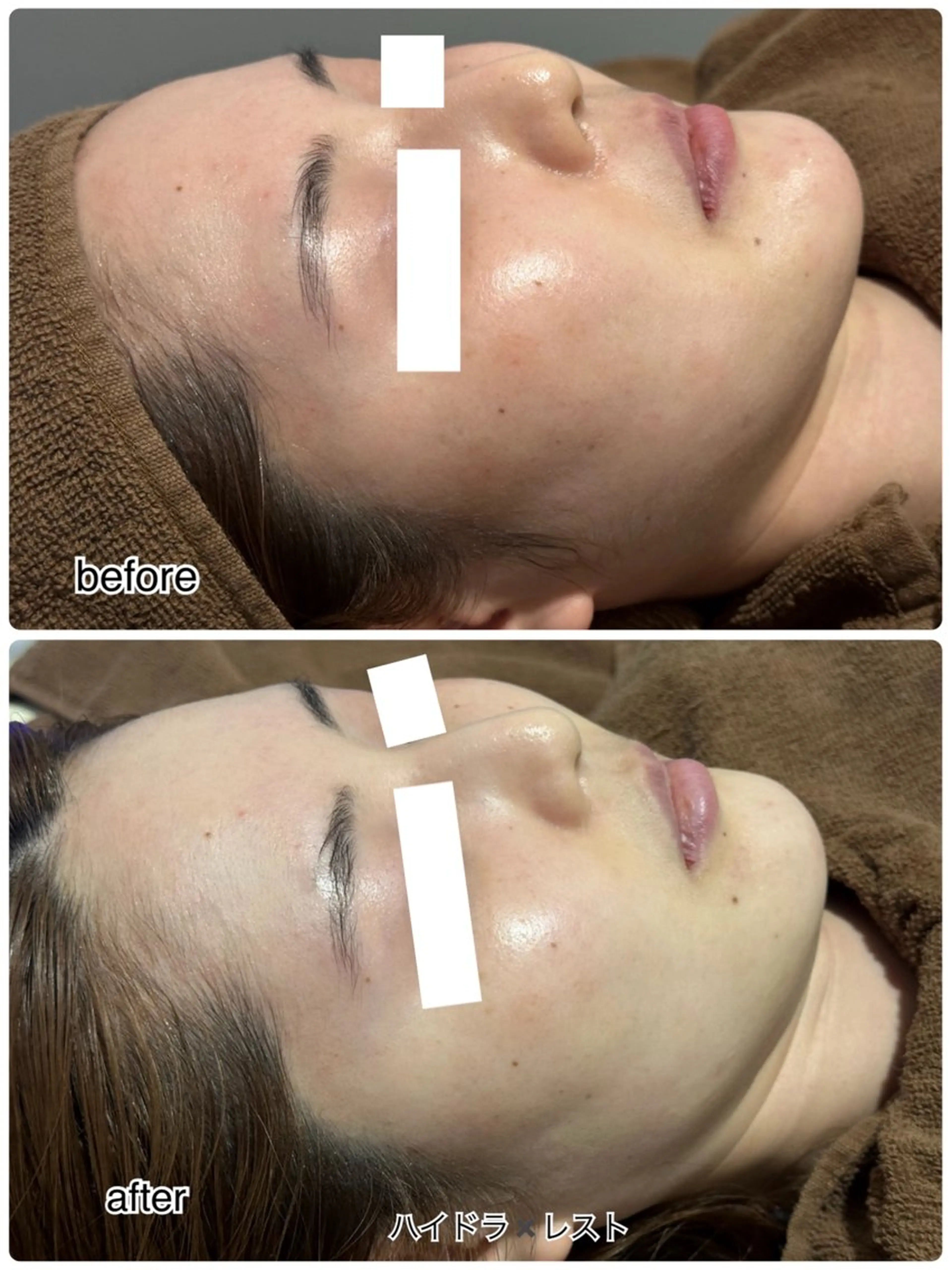 エステ ENCHANT 脱毛.小顔.毛穴のエステ・リラクイメージ