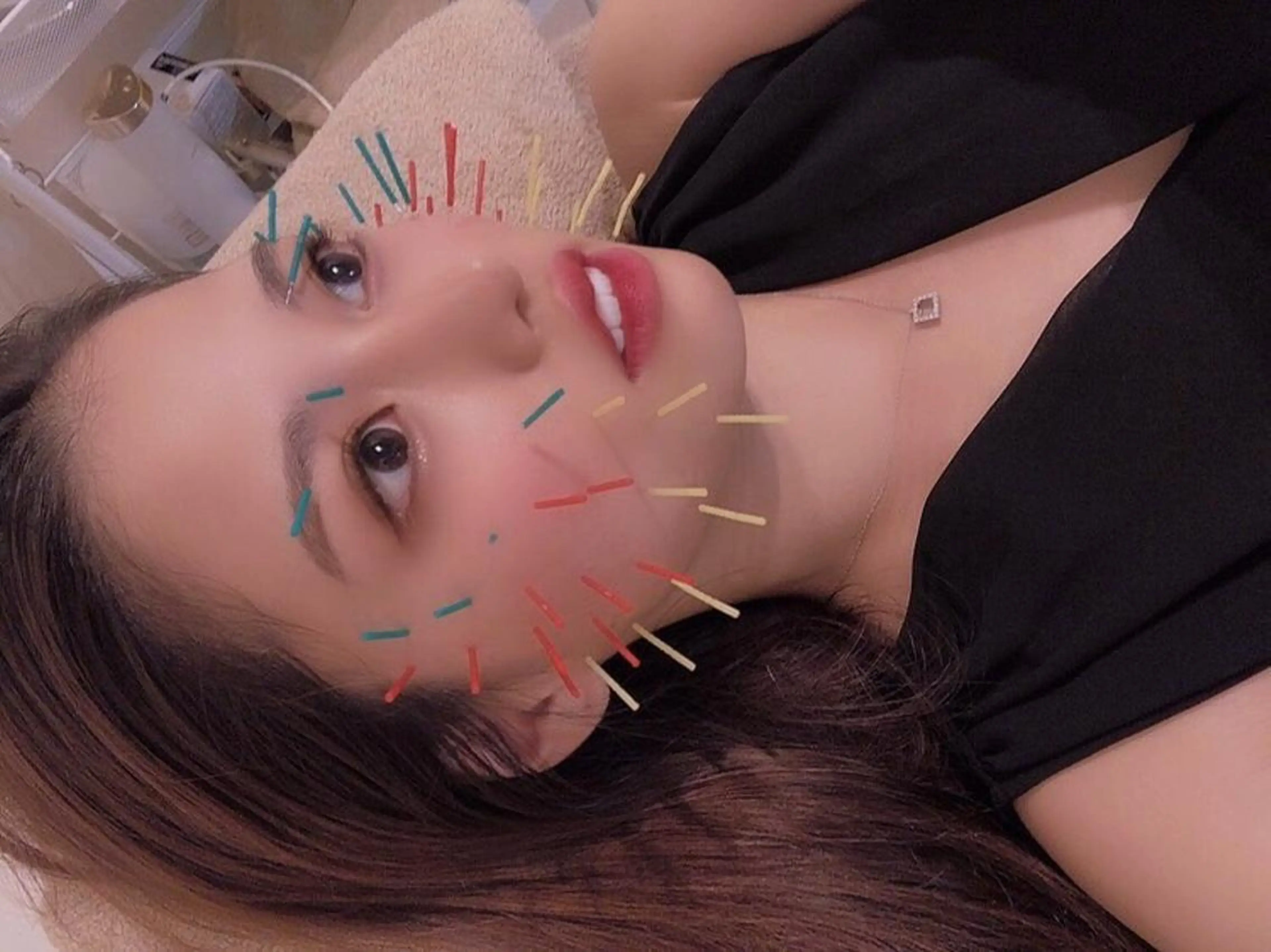 鍼灸整骨院Refine所属・鍼灸 Refineのその他イメージ