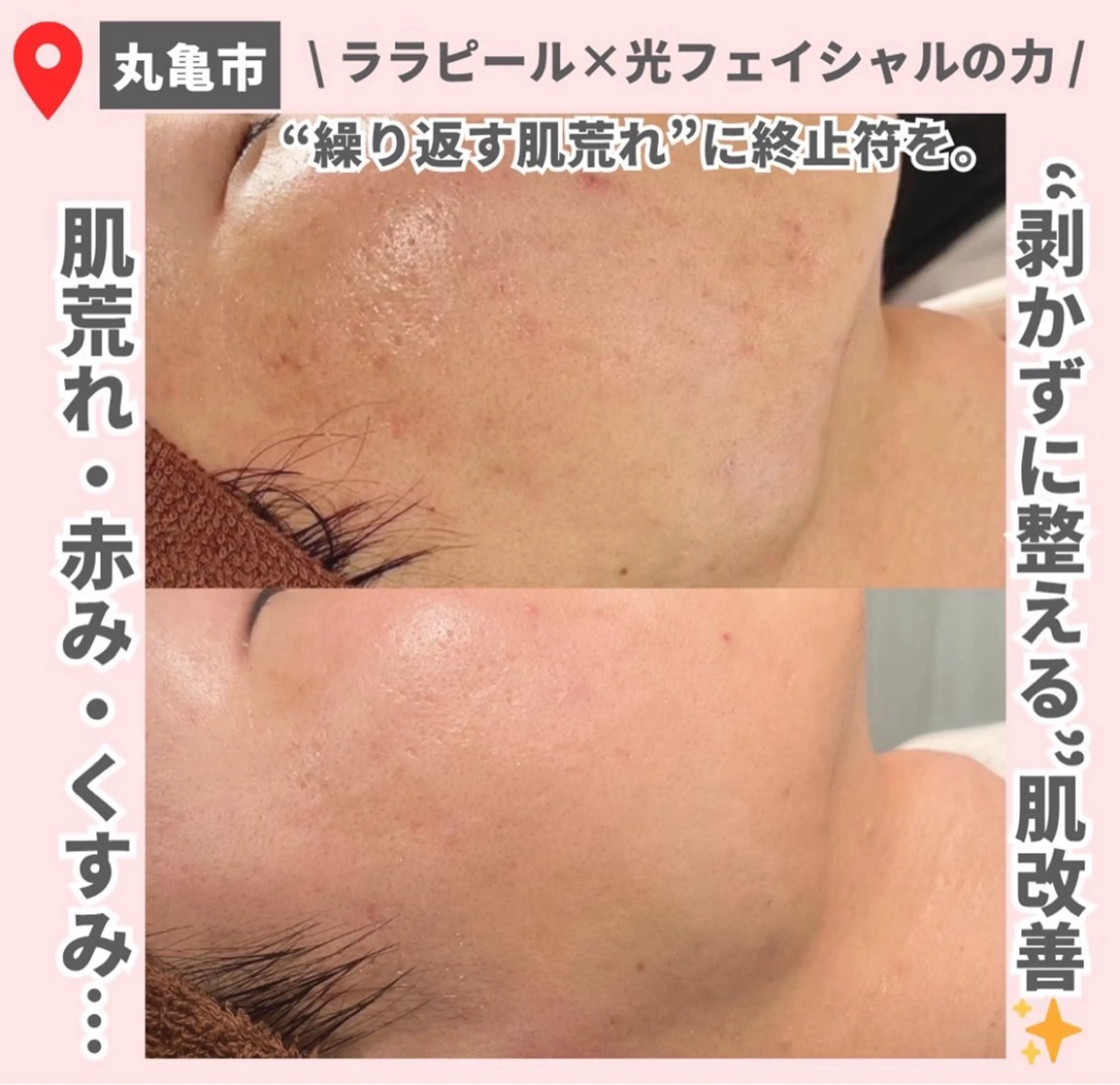 前山 くるみのエステ・リラクイメージ