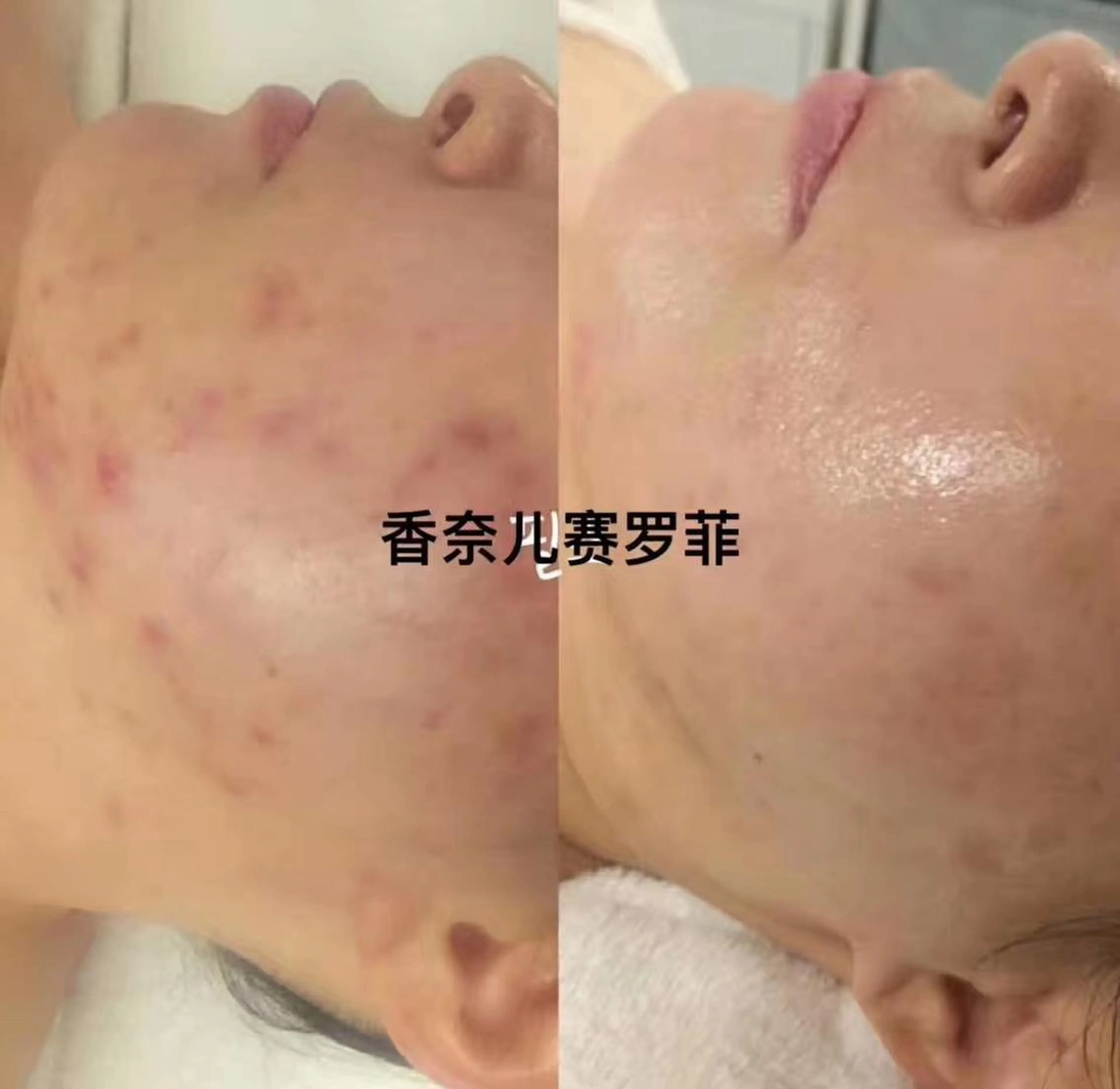 aliaハイフ&水光ジェットサロン所属・aliaハーブ水光店 エステティシャン募集のエステ・リラクイメージ