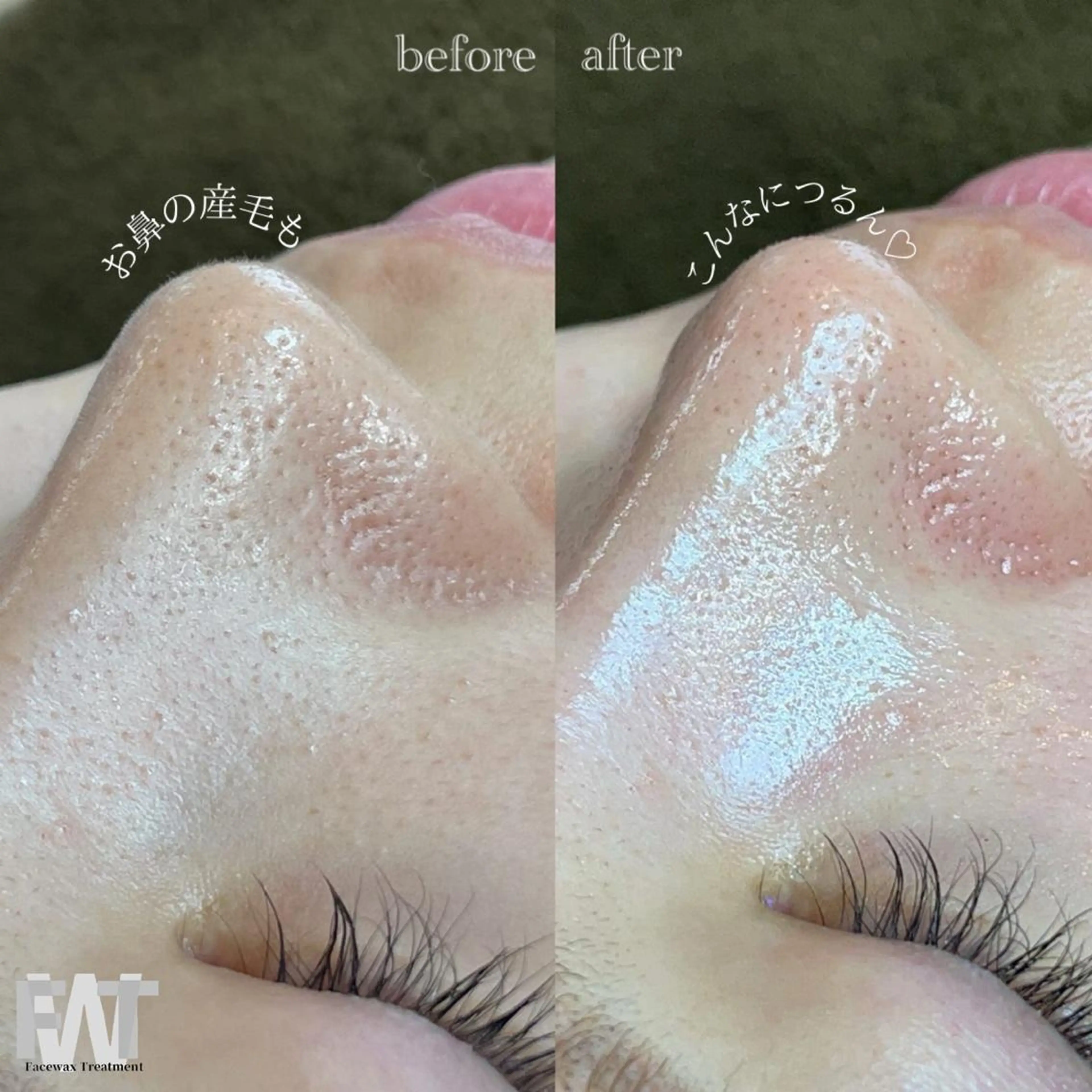 エステ リラク meili beautyのエステ・リラクイメージ