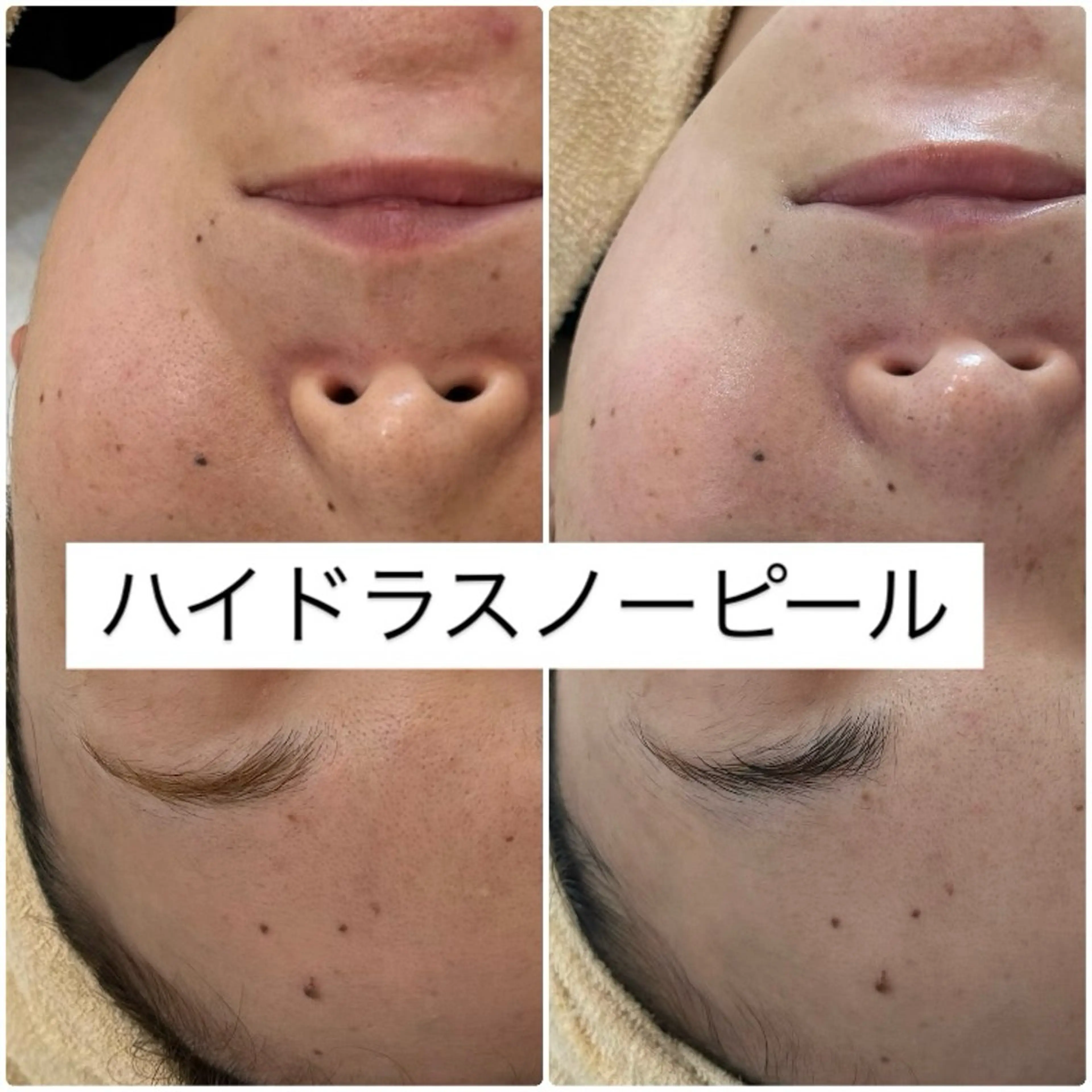 エステ リラク 肌質管理専門店 Lé pia　AMIのエステ・リラクイメージ