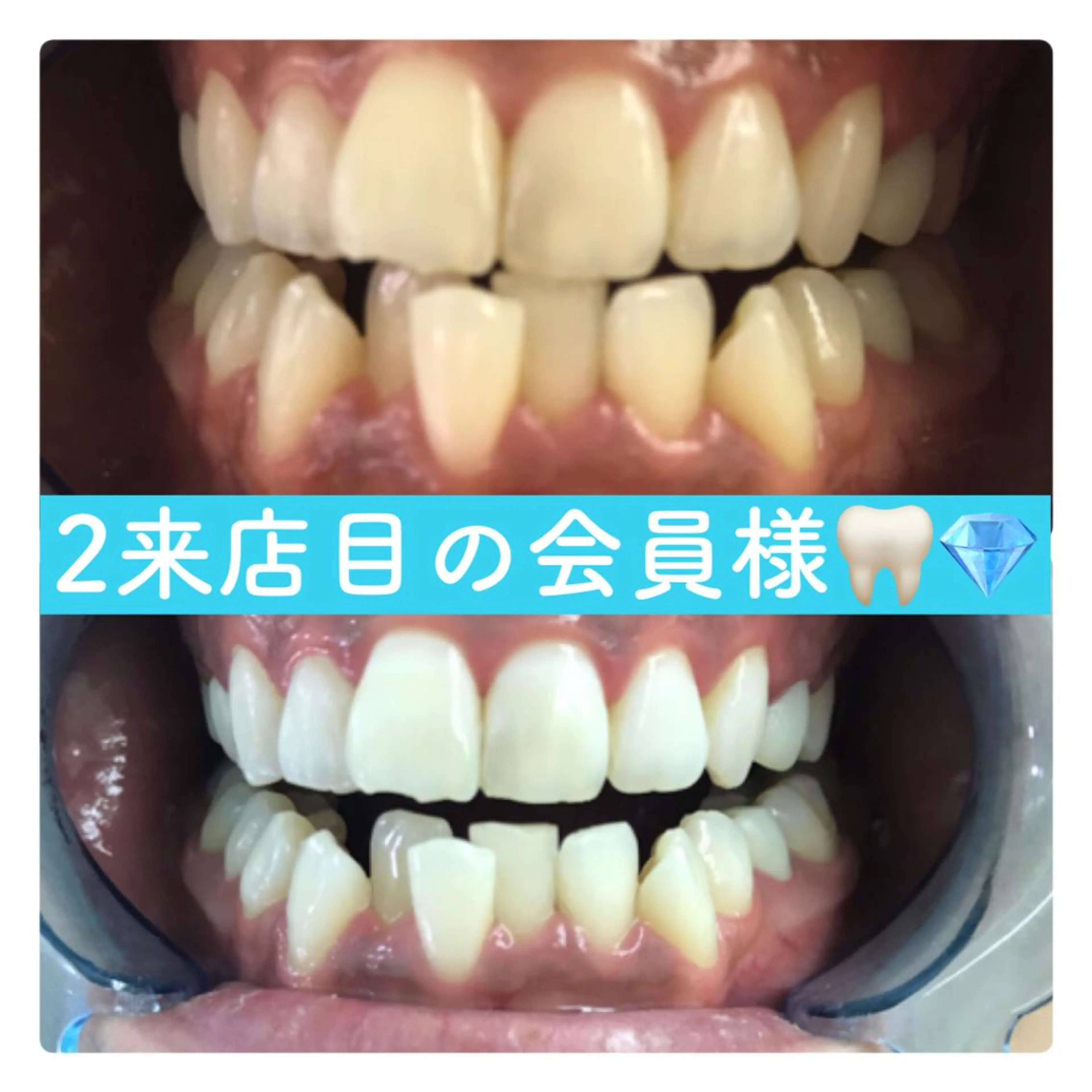 PLATINUM Beauty 横浜店所属・ホワイトニングルーム 横浜店のその他イメージ