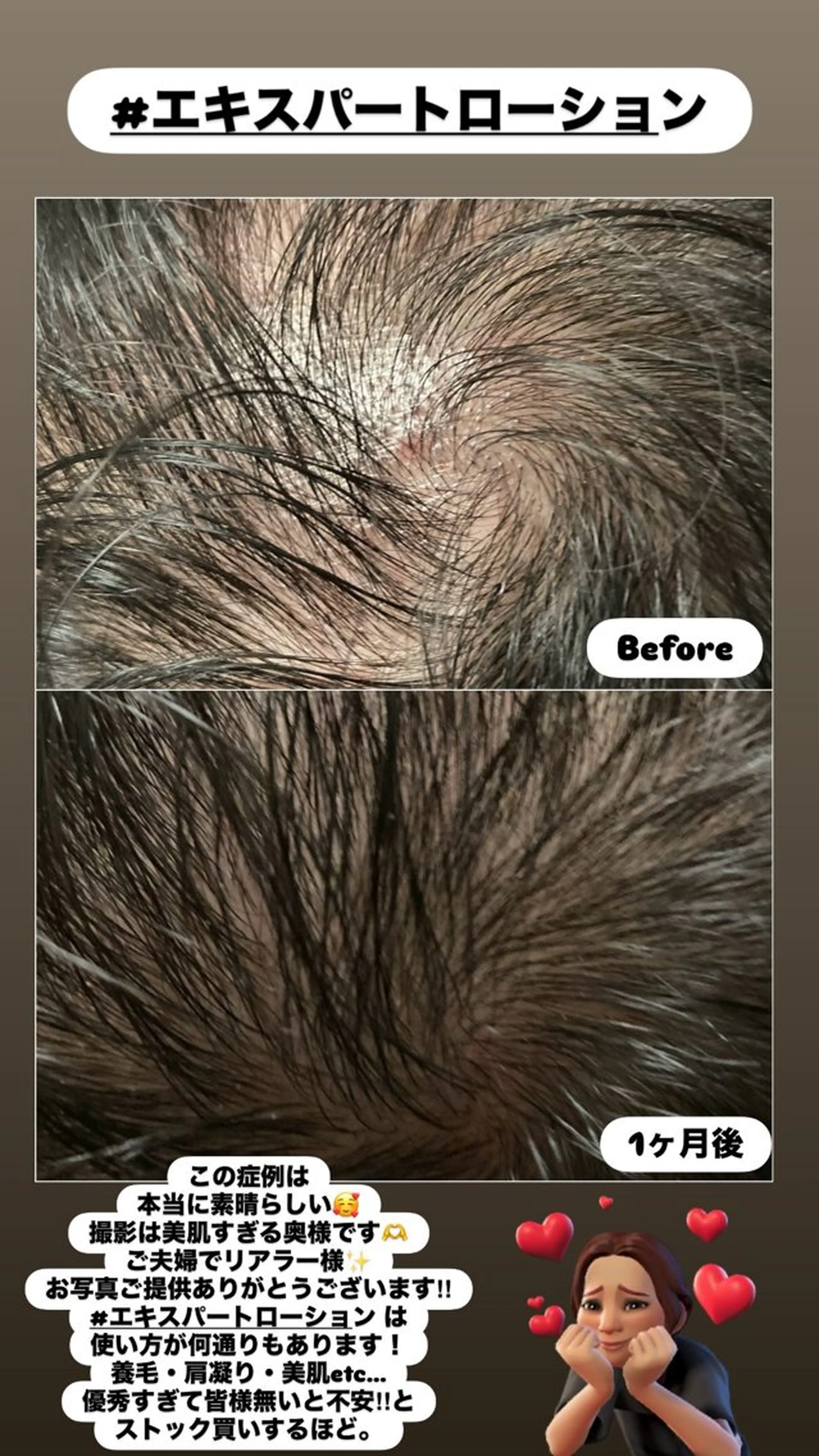 エステ LiZA エステティックサロンのエステ・リラクイメージ