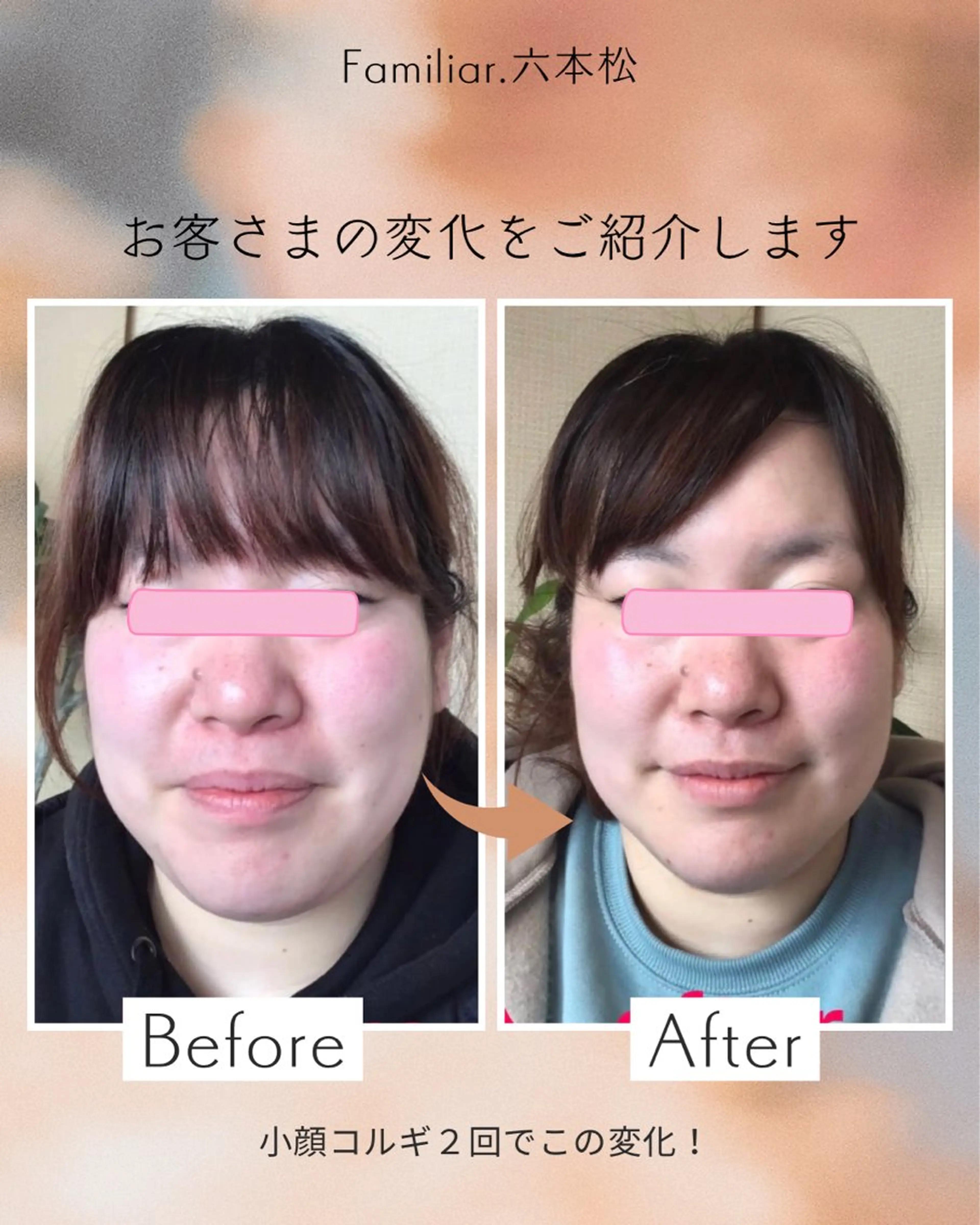 小顔コルギ 45分の写真