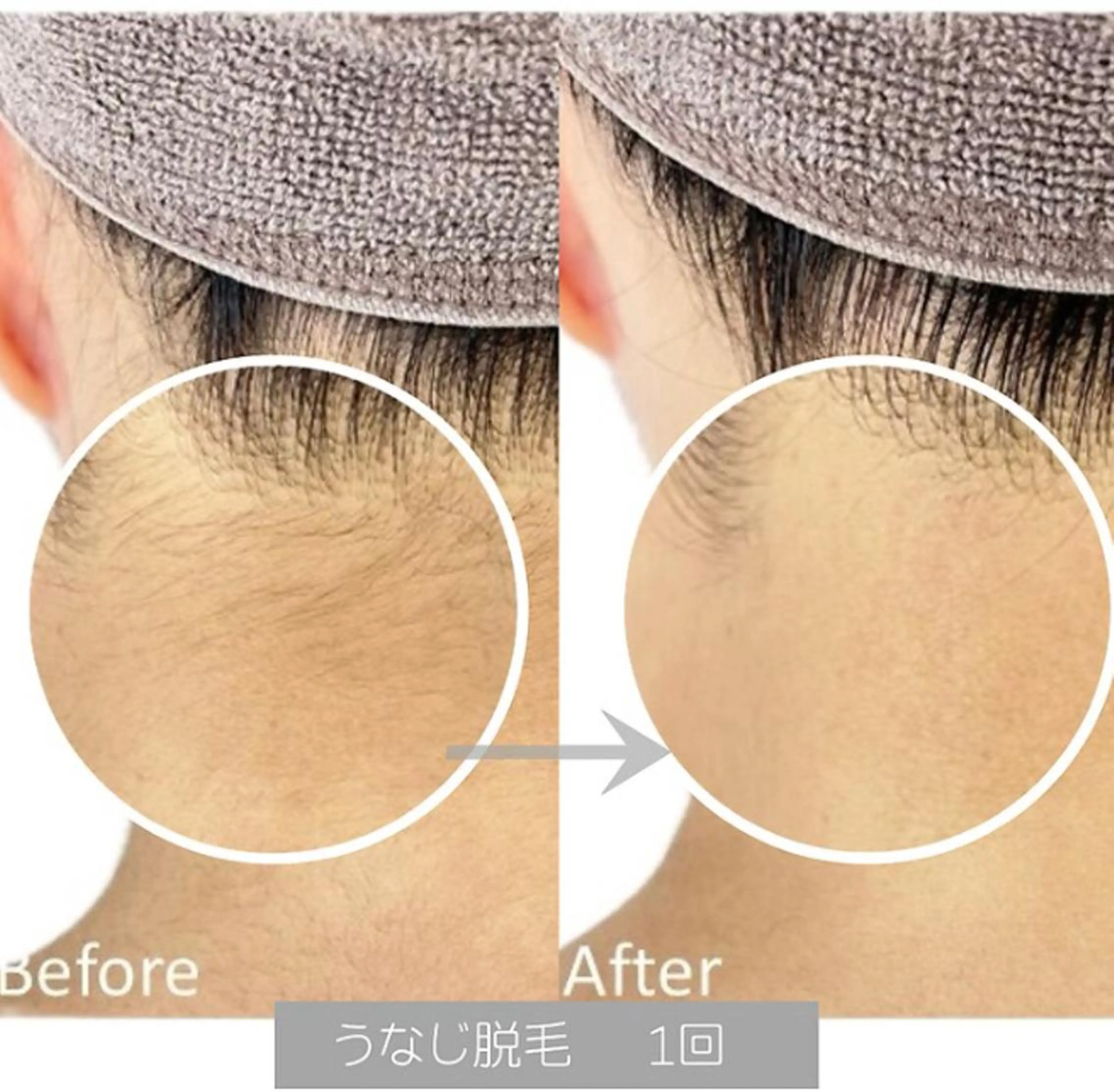 脱毛 Adam Umiのエステ・リラクイメージ