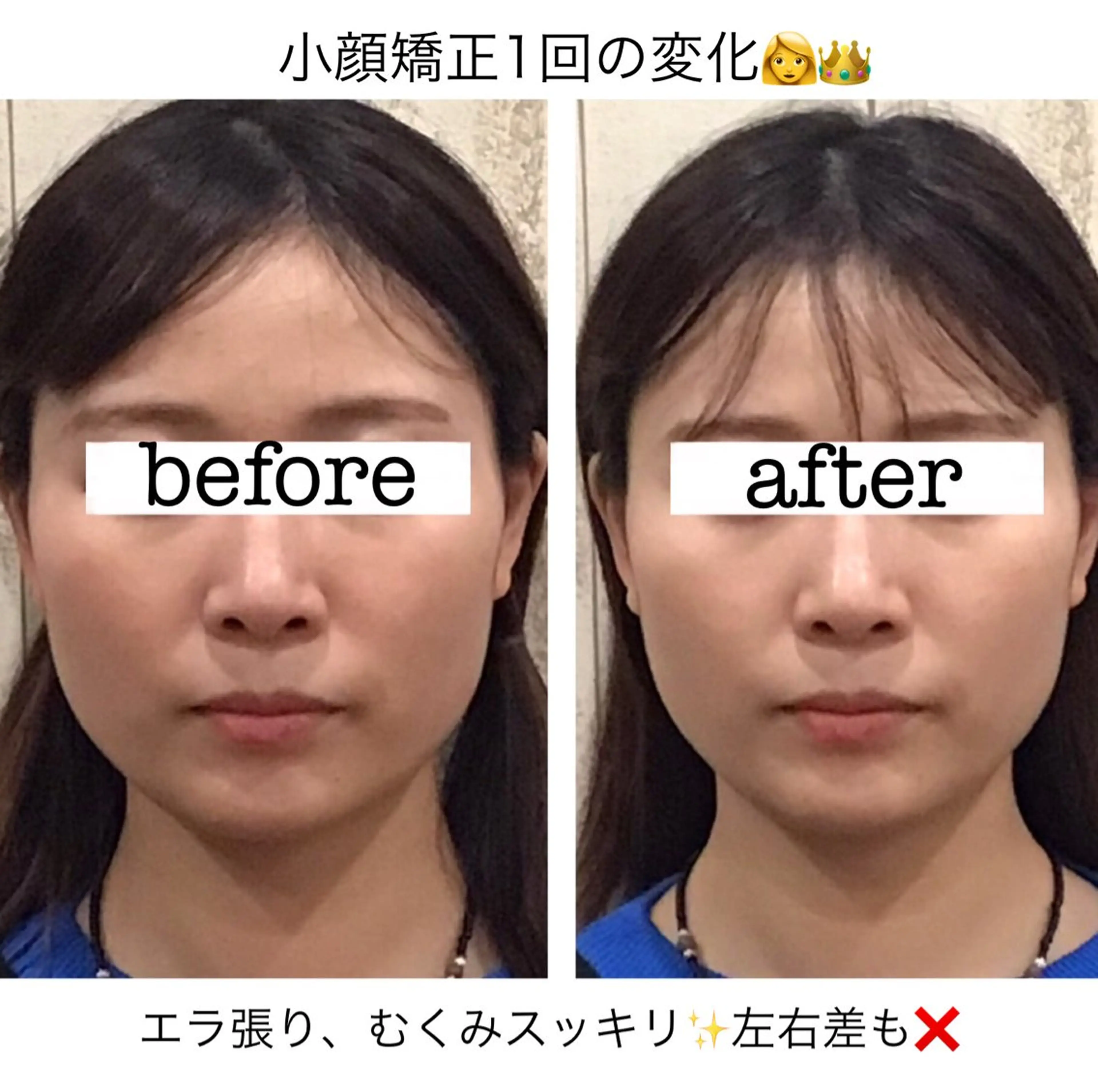 エステ リラク 小顔矯正/姿勢矯正 ハイフ😊Nagiのエステ・リラクイメージ