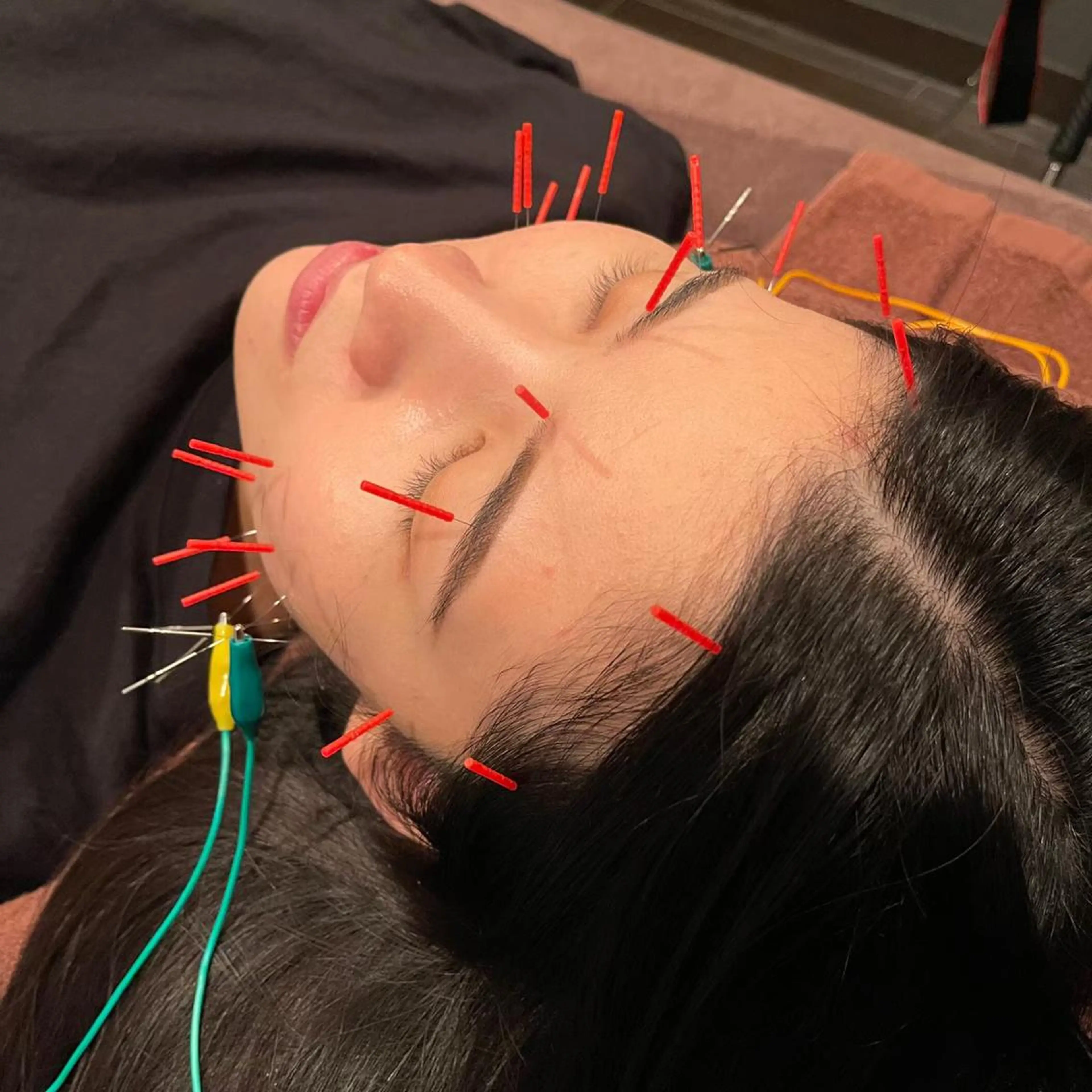 小林整骨院玉川 キジマのエステ・リラクイメージ