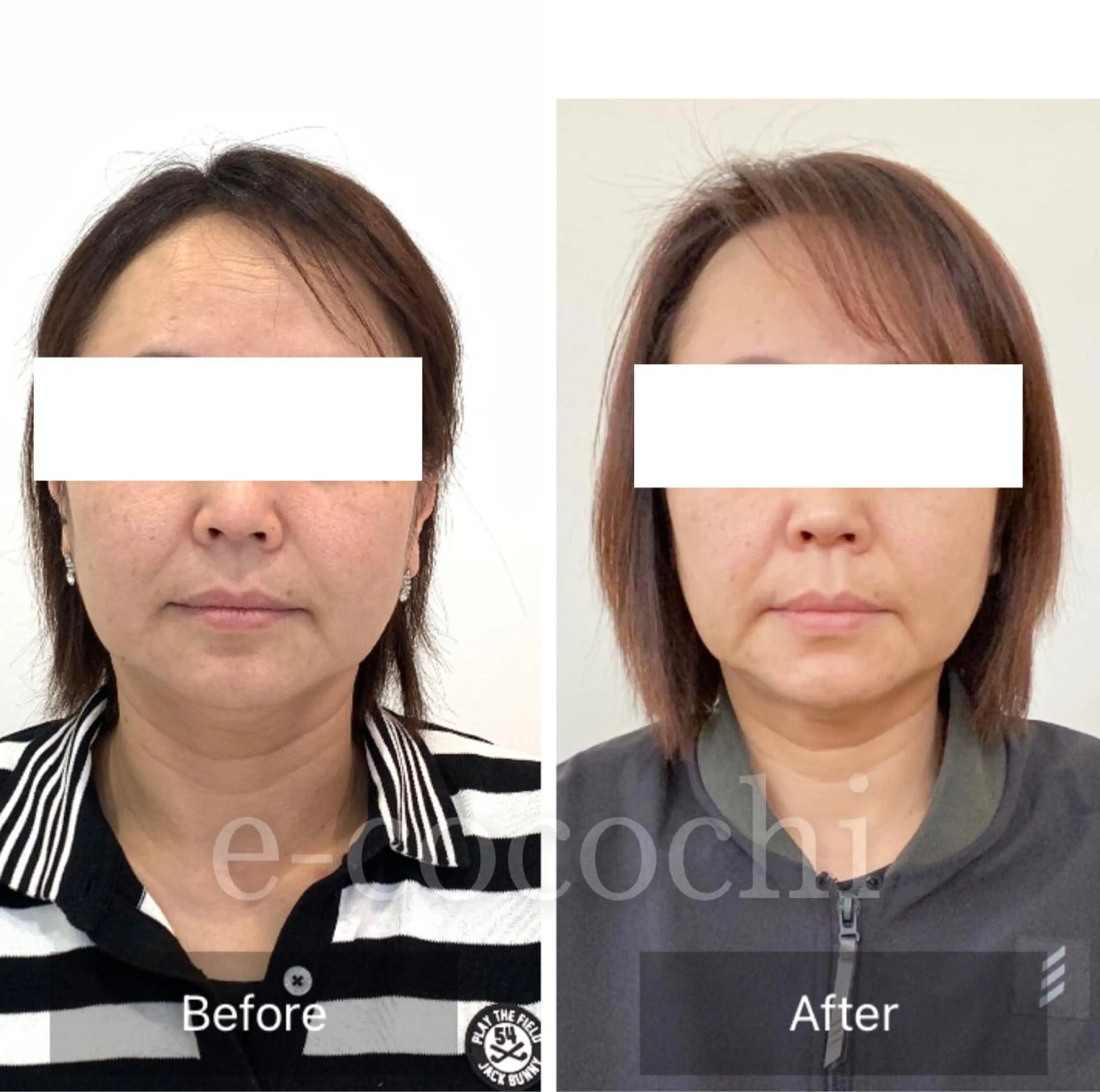 エステ リラク 小顔と ヘッドスパのお店のエステ・リラクイメージ