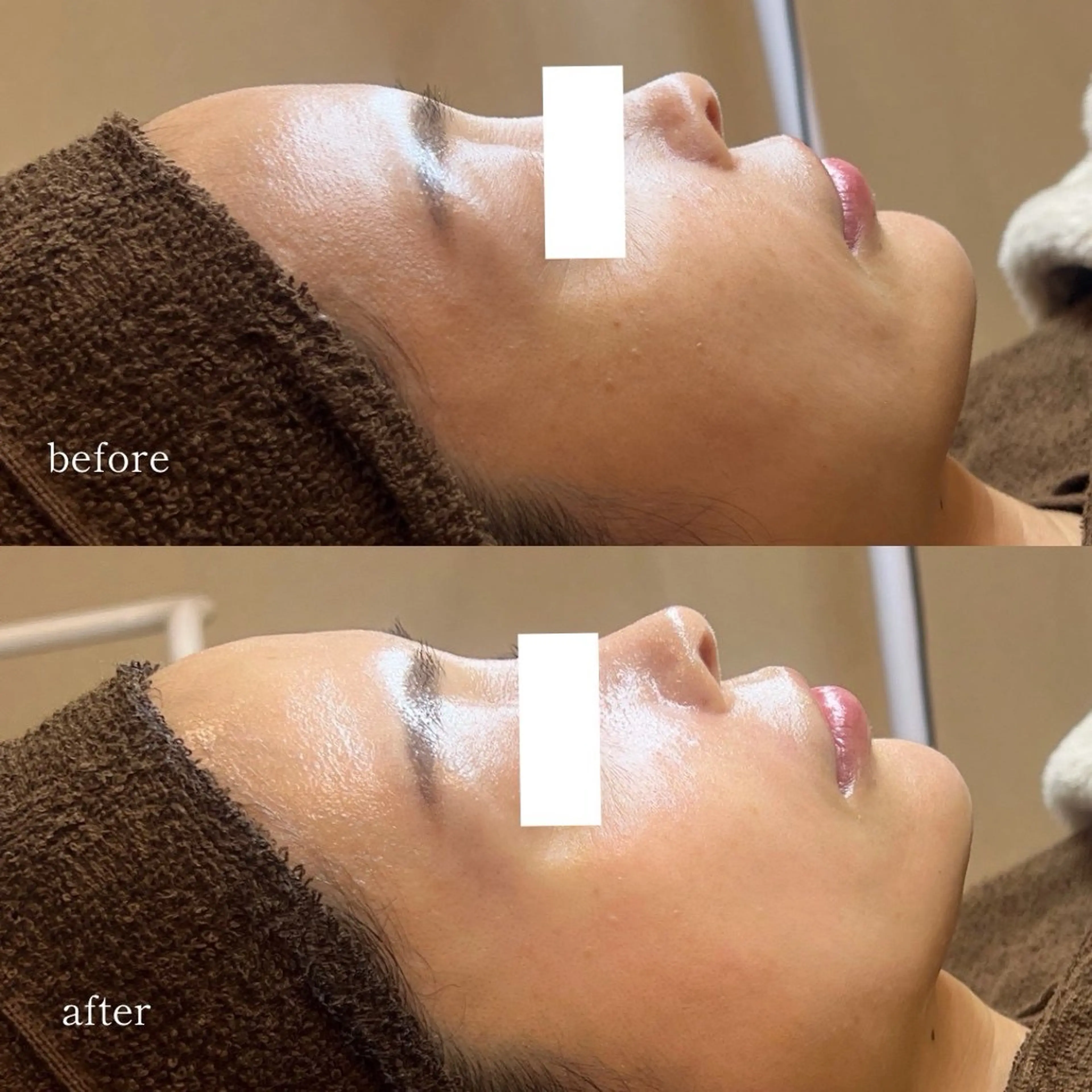 エステ EARNEST大阪 心斎橋【韓国肌管理】のエステ・リラクイメージ