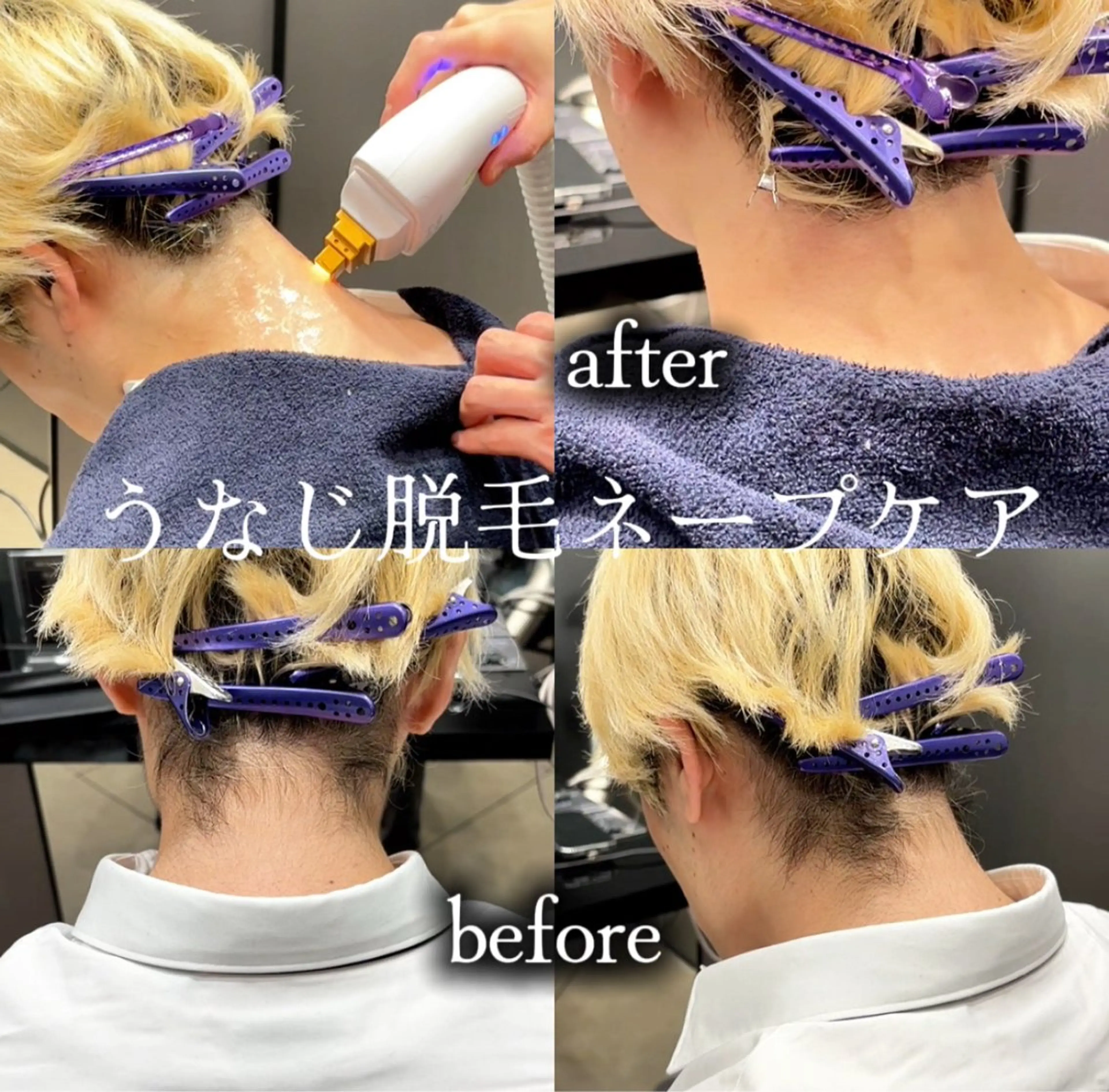 脱毛 HARUKI  MINATO Japan広島紙屋町店所属・hmj紙屋町店 脊戸智志のヘアスタイル