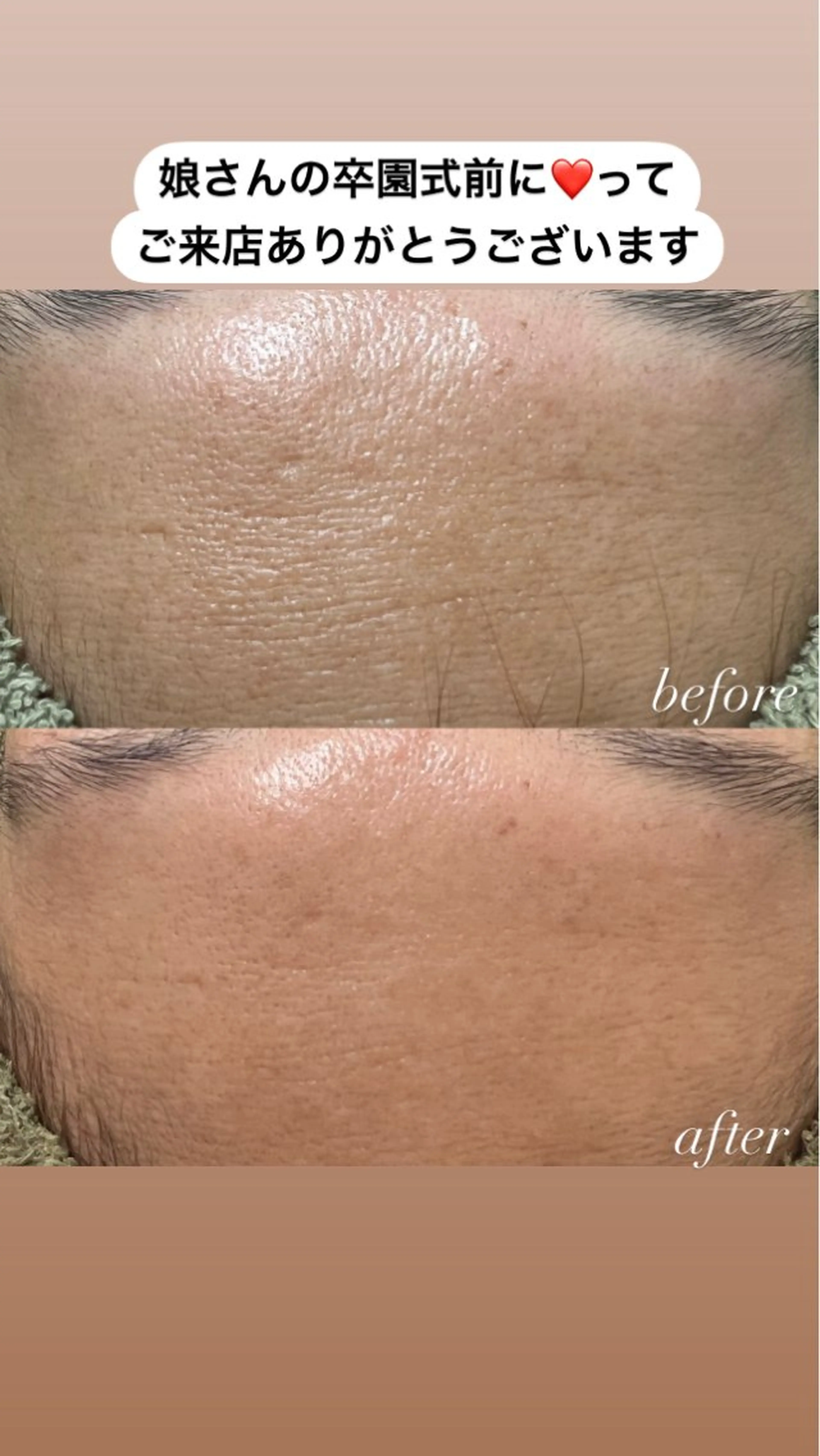 Beauty   Salon  Adiy所属・Adiy ikumiのエステ・リラクイメージ