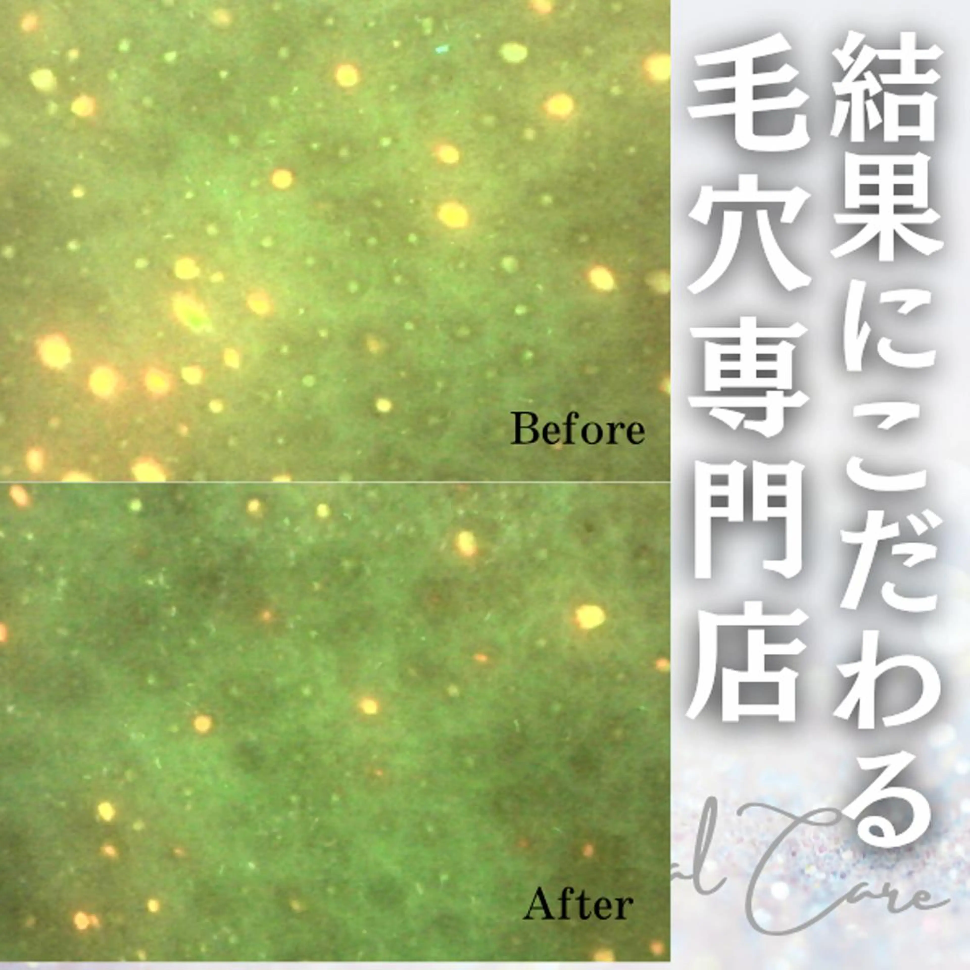 【人気No.1】肌に合わせたオーダーメイドケア！黒ずみ・皮脂トラブル・しみの写真
