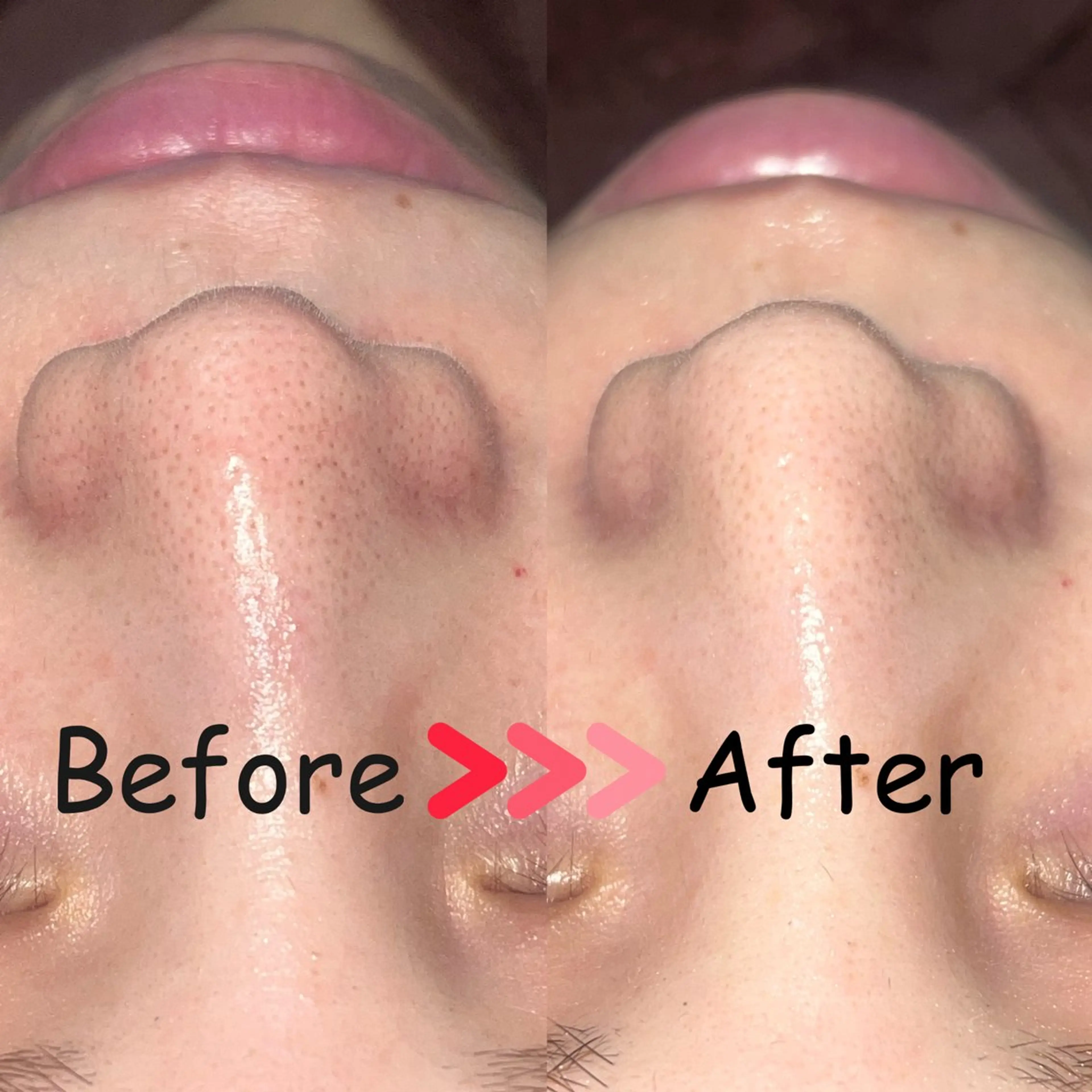 脱毛/毛穴ケア/小顔 博多アンドナイン平尾の眉毛・アイブロウイメージ