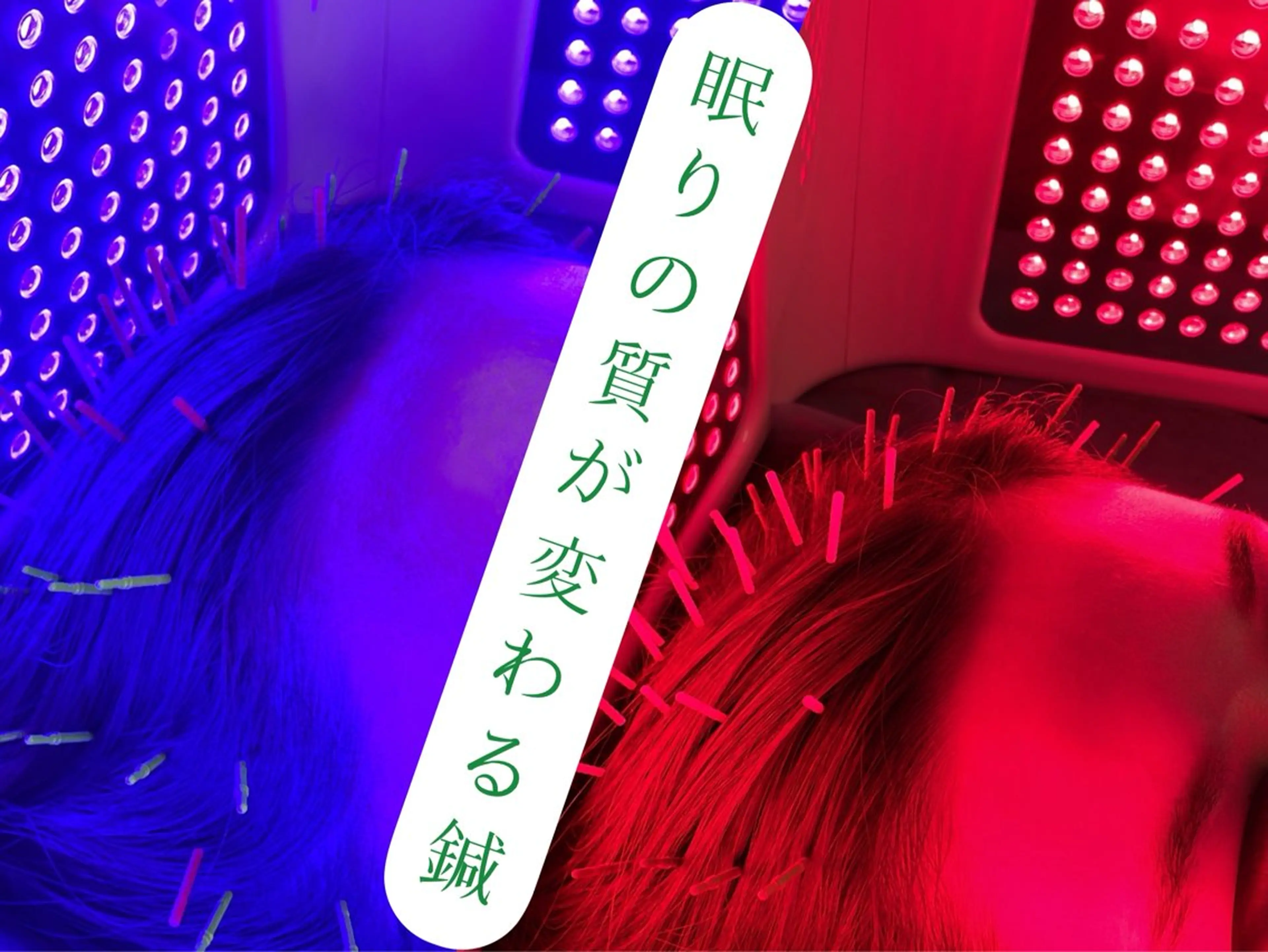 🔹ウルトラヘッドLED美容鍼🔹【不眠】眠れない人におすすめ🌟の写真