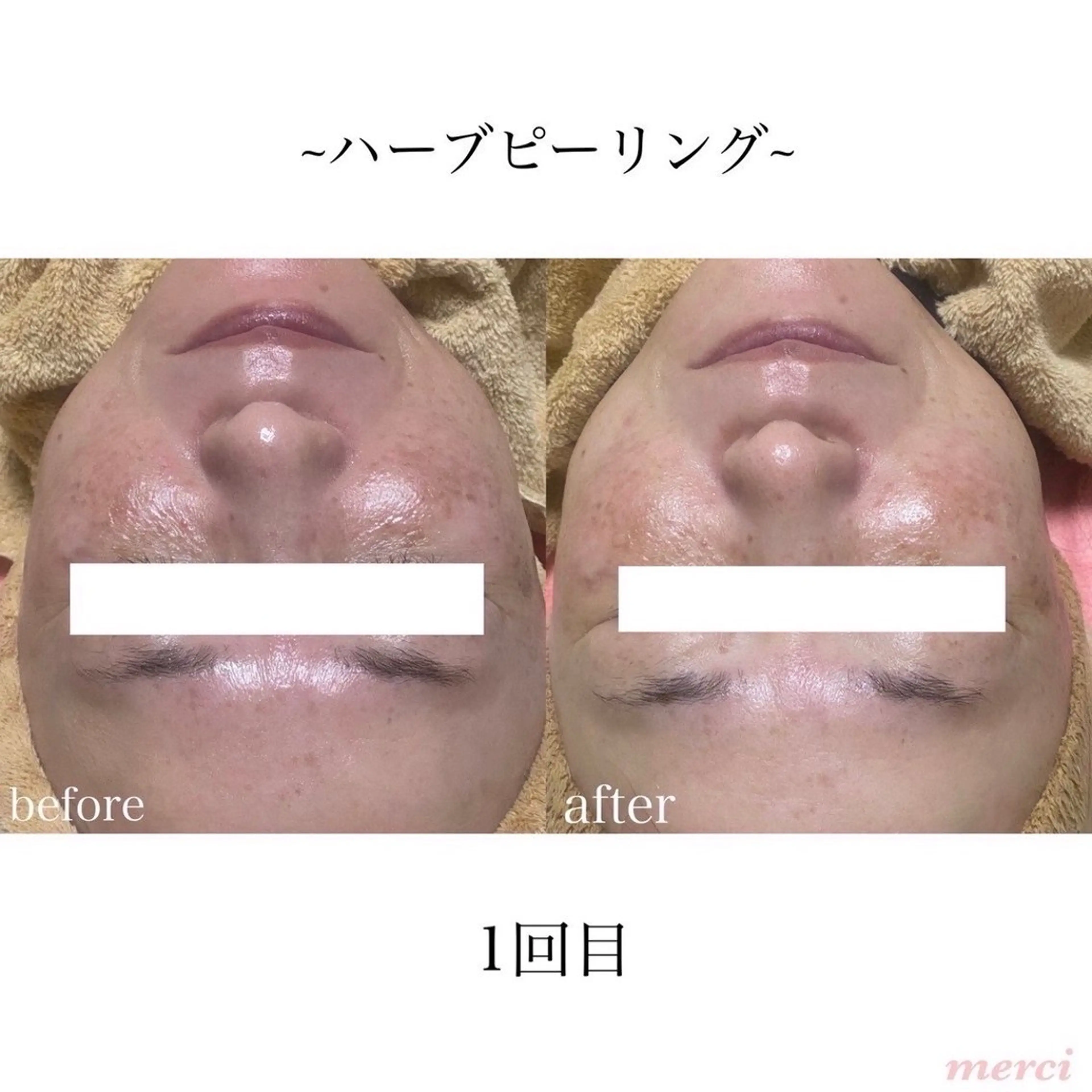 salon merciのエステ・リラクイメージ