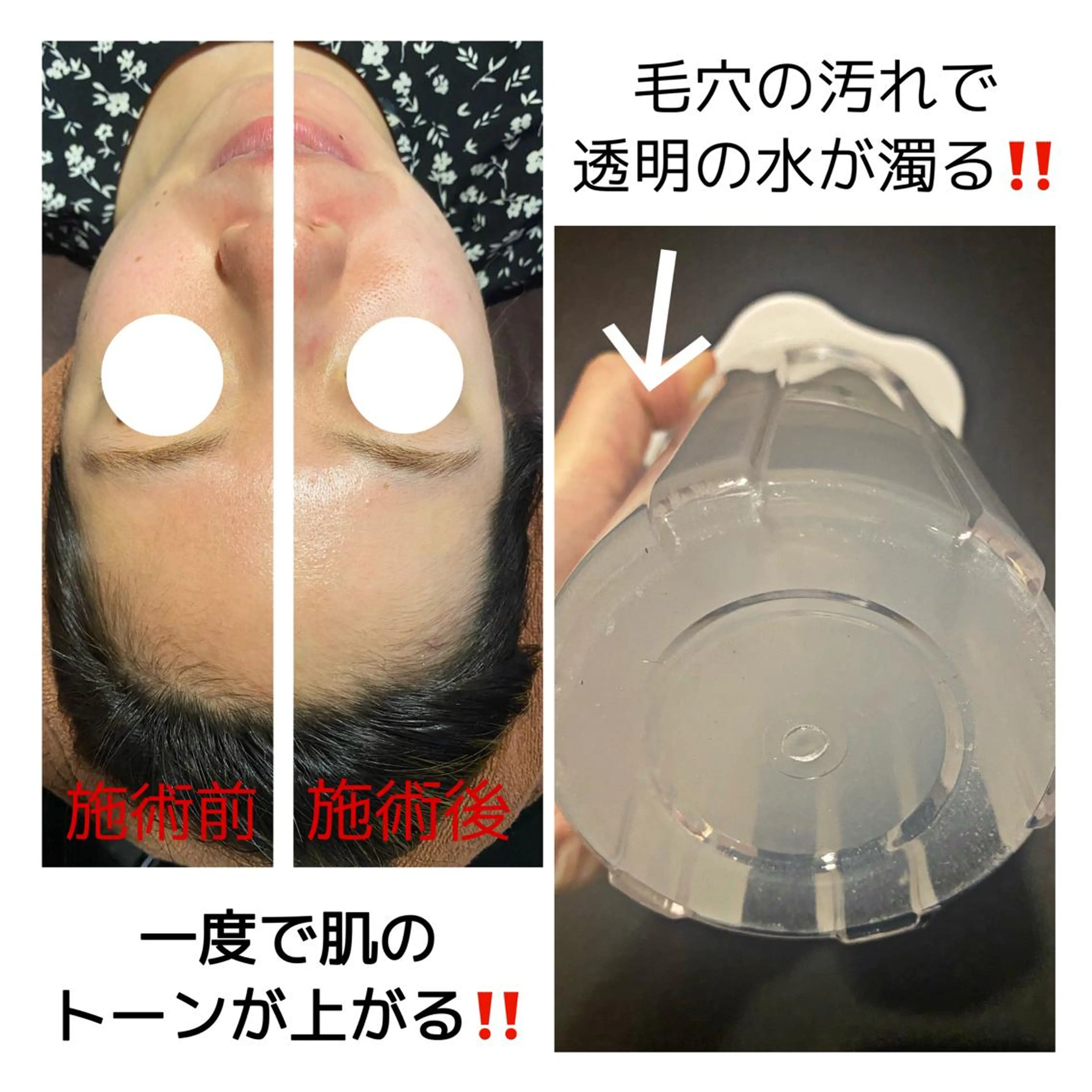 ハーブピーリング・毛穴ケア専門サロンSalon de LENA所属・ハーブピーリング 専門店/名古屋駅前店のエステ・リラクイメージ